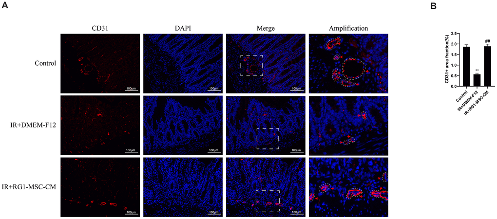 RG1-MSC-CM improves the angiogenesis of intestine in irradiated rats. (A) Immunofluorescence staining with CD31. Intestinal samples were collected and stained on day 3 after radiation. Arrowheads indicate a CD31-positive area. Scale bars 100 μm. (B) Quantification of CD31+ area fraction. Data represent mean ± SD for “hot spot” area. Each group contains at least 3 rats (3-4 section/rat). ##, P **, P 