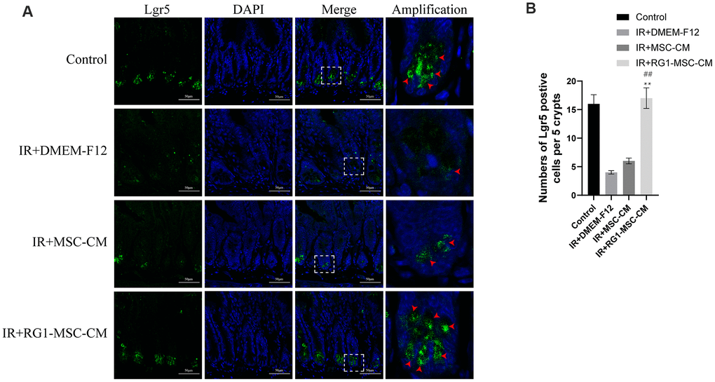 RG1-MSC-CM improves regeneration of intestinal stem cells (ISCs) in the irradiated rats. (A) Immunofluorescence staining with Lgr5. Intestinal samples were collected and stained on day 3 after radiation. Arrowheads indicate Lgr5-positive cells. Scale bars 50 μm. (B) Quantification of Lgr5-positive cells. n = 3~5 in each group. The number of positive cells in 5 crypts was scored in 100 crypts per section and reported as mean ± SD. **, P ##, P 
