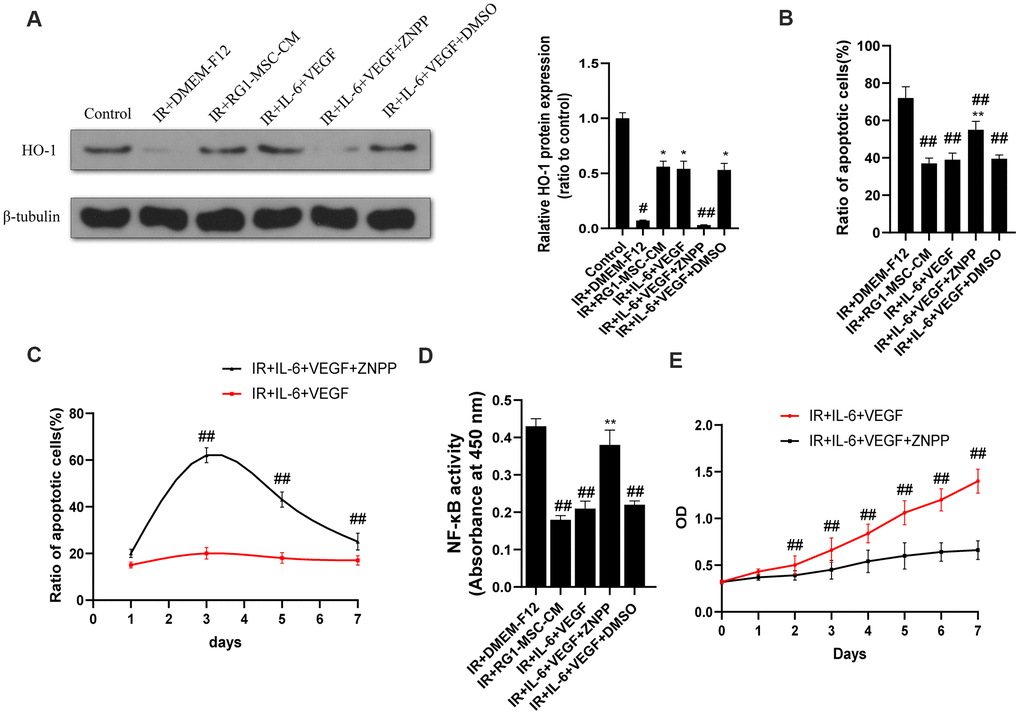 The therapeutic effect of IL-6 and VEGF is partially mediated via HO-1 dependent mechanism. (A) The protein levels of HO-1 in IEC-6 were detected by western blot assays on day 3 after radiation with β-tubulin as the internal control. Data represent the mean ± SD (n=3). *, P #, P ##, P B) Inhibition of HO-1 partially inhibits the therapeutic effect of IL-6 + VEGF on apoptosis of IEC-6. The ratio of apoptosis IEC-6 cells was determined by PI/Annexin V staining on day 3 after radiation. Data represent mean ± SD of three independent experiments. **, P ##, P C) The ratio of apoptosis IEC-6 cells was determined by PI/Annexin V staining on 1, 3, 5, 7 days of the experiment. Data represent mean ± SD of three independent experiments. ##, P D) The activity of NF-κB p65 in IEC-6 was measured by an ELISA-based assay directed against the p65 subunit of NF-κB. Data represent the mean ± SD (n=3). ##, P **, P E) Cell viability was detected by CCK-8 from day 0 to day 7 after radiation. ##, P 