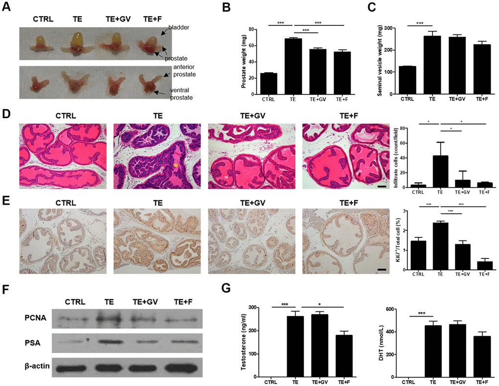 Decreased prostate cell proliferation and immune cell infiltration by GV1001 in BPH mice. BPH mice received either GV1001 (GV, 250 μg/head) or finasteride (F, 100 mg/kg) for 2 weeks. (A) A representative prostate from each group is shown (n=7 mice/group). Upper panels show the urinary bladder and lower panels do not. (B) The weight of prostate and (C) seminal vesicles was measured at the end of the experiments. ***pD, E) Prostates were excised, fixed and stained (D) with hematoxylin and eosin (H&E) and (E) with an anti-Ki67 antibody. Scale bar, 100 μm. The bar graph shows the number of infiltrating immune cells and Ki67-positive cells. ***pF) Expression of PCNA and PSA in prostate cell lysates was examined by immunoblotting; β-actin was used as an internal control. (G) Plasma concentration of testosterone and DHT was measured using EIA kits. ***p