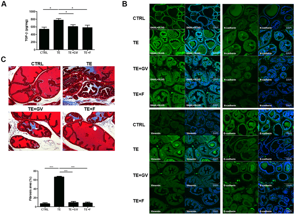 Regulation of TGF-β production and EMT-related molecules, and alleviation of fibrosis, by GV1001 in the prostate of BPH mice. BPH mice were treated with GV1001 (GV) or finasteride (F) for 2 weeks. (A) After prostates were homogenized, the level of TGF-β in the lysates was measured in an ELISA. *pB) Expression of EMT-related proteins (Snail, Slug, N-cadherin, Vimentin, and E-cadherin) in the prostate was examined by immunofluorescence. Scale bar, 150 μm. (C) Prostates were fixed and sections were stained with Masson’s Trichrome. Scale bar, 100 μm. Asterisks (*) indicate smooth muscle (red). Collagen fibers were stained blue. The bar graph shows the area of fibrosis stained positive with Masson Trichrome. ***p