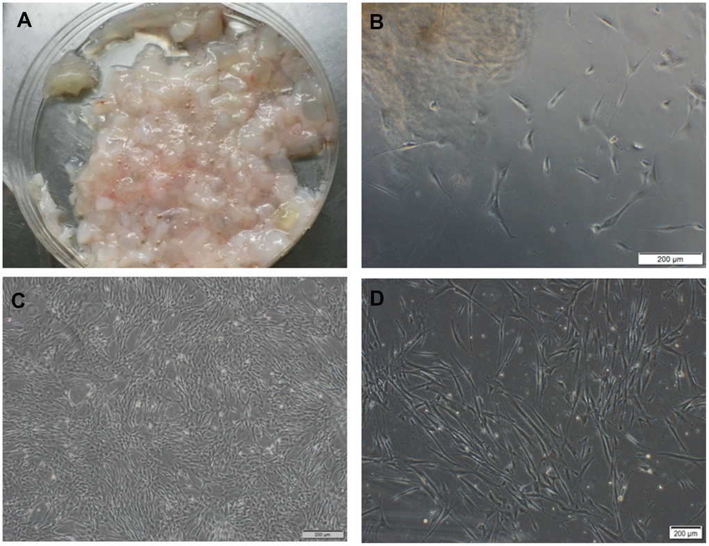 hUC-MSCs isolated from Wharton's Jelly tissue. (A) Wharton's Jelly tissue. (B) A small number of cells crawled out of the tissue block on the 5th day, varying in morphology. Scale bar=200 μm. (C) P5 cells in the shape of vortex or shoal. Scale bar=200 μm. (D) P6 cells after cryopreservation and resuscitation. Scale bar=200 μm.