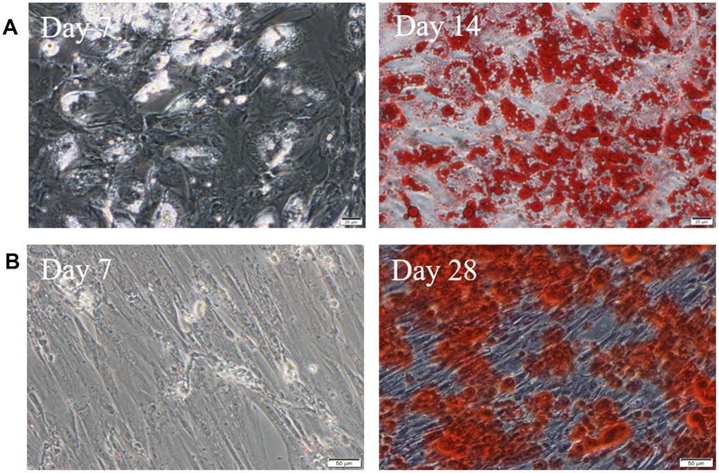 hUC-MSCs induced into adipocytes and osteoblasts. (A) Induced into adipocytes for 7 days and 14 days. The lipid droplets in cells were stained by Oil Red O. Scale bar=50μm. (B) Induced into osteoblasts for 7 days and 28 days. There are bright red calcium nodules stained by alizarin red in cytoplasm. Scale bar=50μm. n=3.