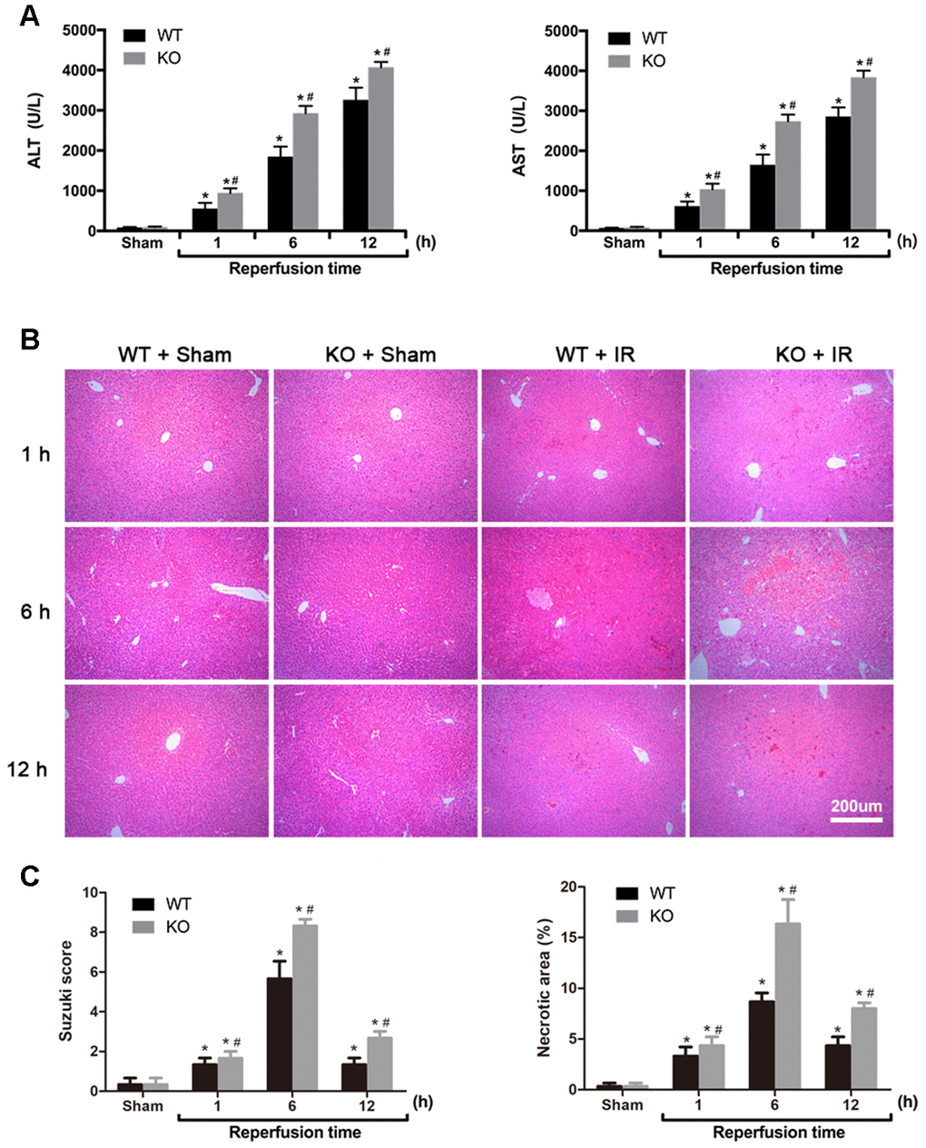 ARRB2 protects against hepatic ischemia-reperfusion injury in mice. (A) Analysis of serum ALT and AST levels in Sham, WT + IR and KO + IR groups. (B) Representative H&E staining of liver tissues (original magnification, 100×). (C) Bar graphs show Suzuki score and necrosis area revealed by H&E staining. The data are presented as the Mean ± SD, n = 6. *P #P