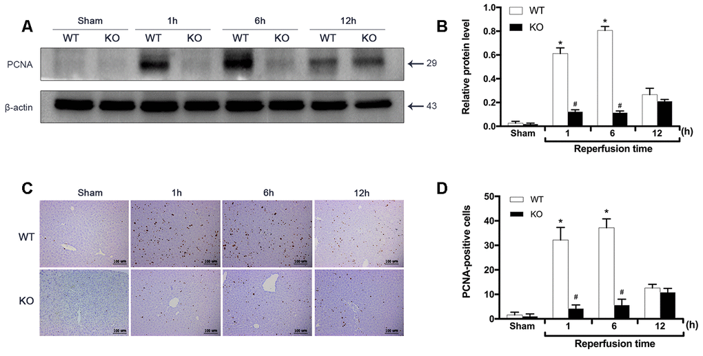 ARRB2 promotes liver proliferation during hepatic ischemia-reperfusion. (A) and (B), PCNA protein level in liver tissue detected by Western Blotting in Sham, WT + IR and KO + IR groups. (C) and (D), Immunohistochemical staining of PCNA in liver tissues (×200). The data are presented as the Mean ± SD, n = 6. *P#P 