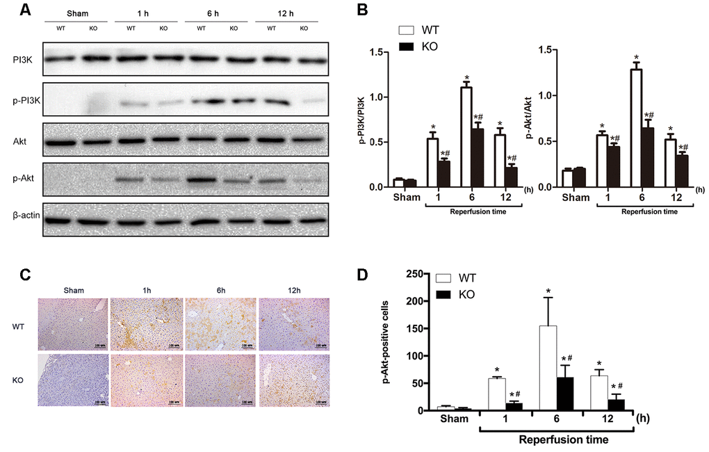 ARRB2 deficiency inhibits PI3K/Akt signaling activation. (A) PI3K, p-PI3K, AKT, p-AKT protein levels in liver tissue detected by Western Blotting in Sham, WT + IR and KO + IR groups. (B) Quantitative analysis of p-PI3K/PI3K levels and p-Akt/Akt levels. (C) and (D), Immunohistochemical staining of p-Akt in liver tissues (×200). The data are presented as the Mean ± SD, n = 6. * P#P 
