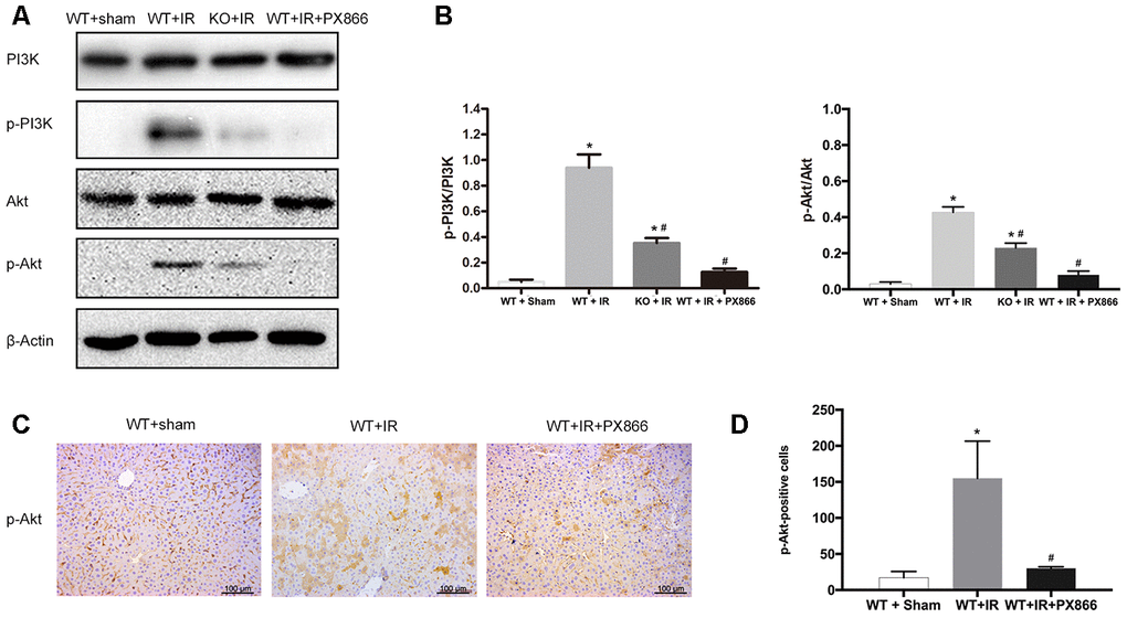 PX866 inhibits PI3K/Akt signaling activation. (A) PI3K, p-PI3K, AKT, p-AKT protein levels at 6 h after reperfusion detected by Western Blotting in Sham, WT + IR, KO + IR, and WT + IR + PX866 groups. (B) Quantitative analysis of p-PI3K/PI3K levels and p-Akt/Akt levels. (C) and (D), Immunohistochemical staining of p-Akt in liver tissues (×200). The data are presented as the Mean ± SD, n = 6. *P#P