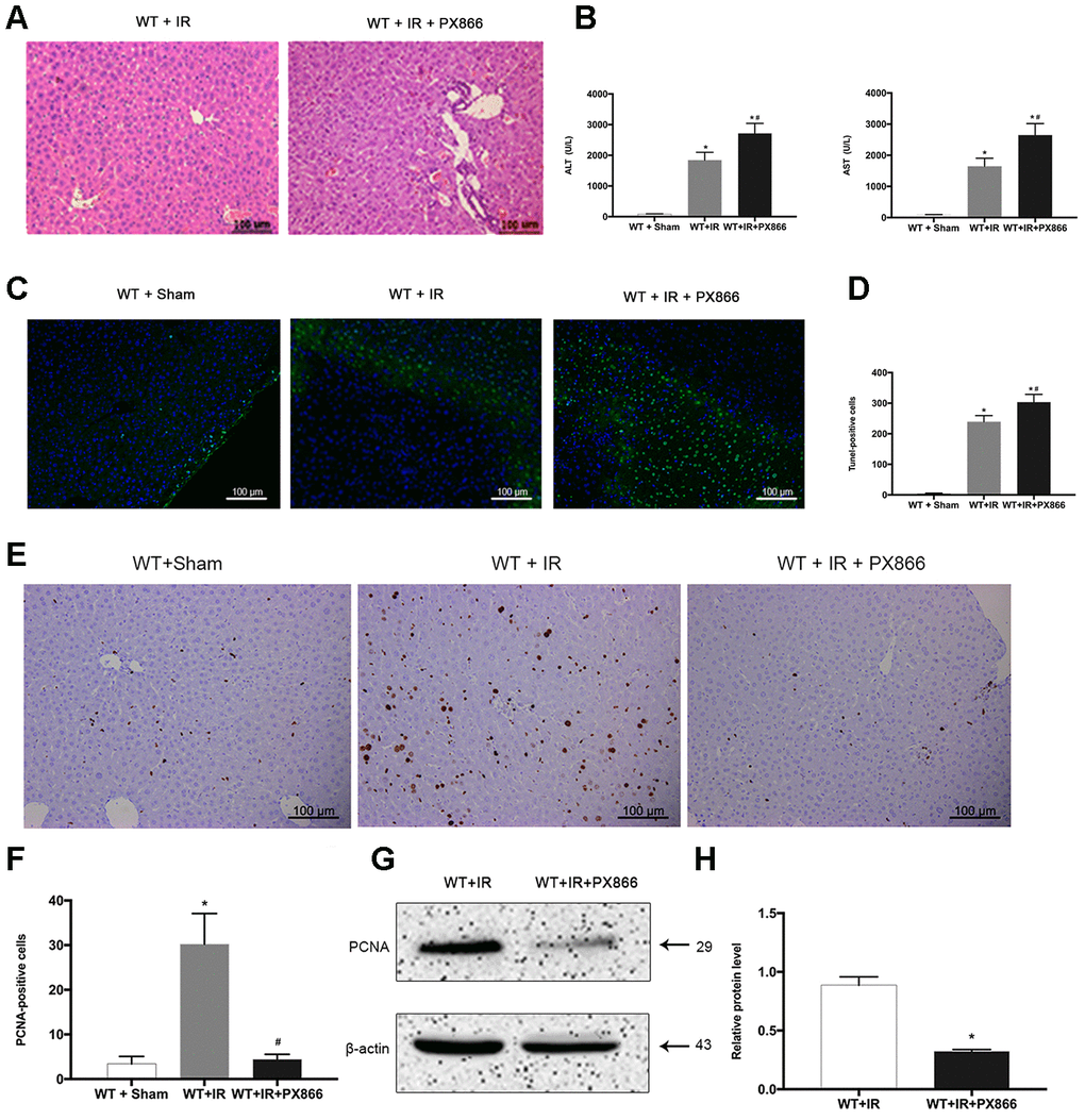 Inhibition of PI3K/Akt signaling aggravates hepatic ischemia-reperfusion injury in mice. (A) Representative H&E staining of liver tissues at 6 h after reperfusion in WT + IR and WT + IR + PX866 groups (×200). (B) Analysis of serum ALT and AST levels (C) and (D), TUNEL positive cells (green) at 6 h after reperfusion. (E) and (F), PCNA protein in liver tissues detected by immunohistochemical staining (×200). (G) and (H), PCNA protein in liver tissue 6 h after reperfusion detected by Western Blotting. The data are presented as the Mean ± SD, n = 6. *P#P