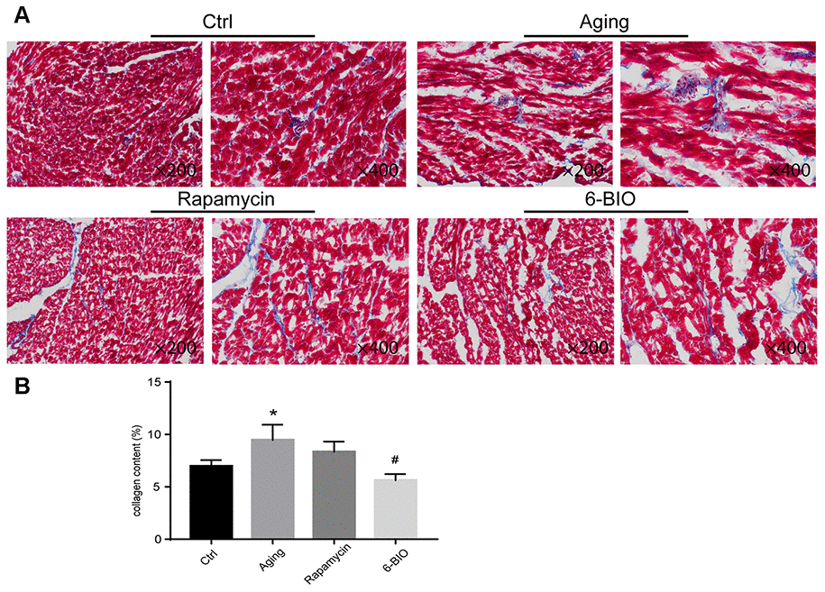 (A, B) Representative photomicrographs of Masson-stained myocardium (×200 and ×400). *P