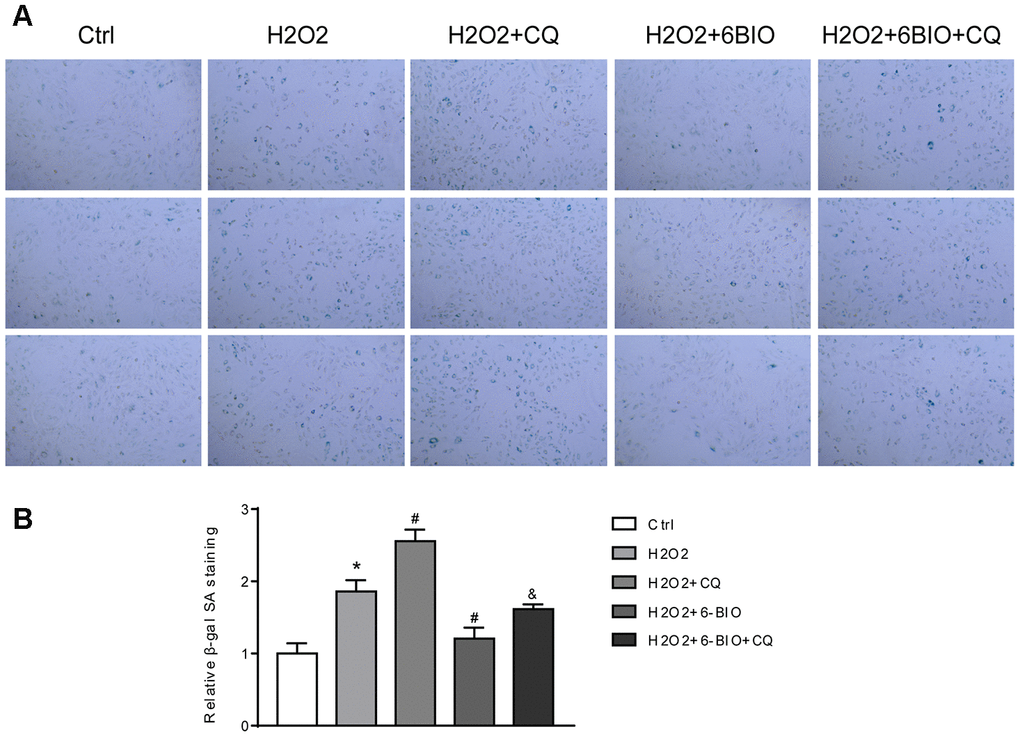 (A) Representative pictures of senescence-associated β -gal staining (×200) and (B) evaluation of senescence-associated β -gal activity assay. *P