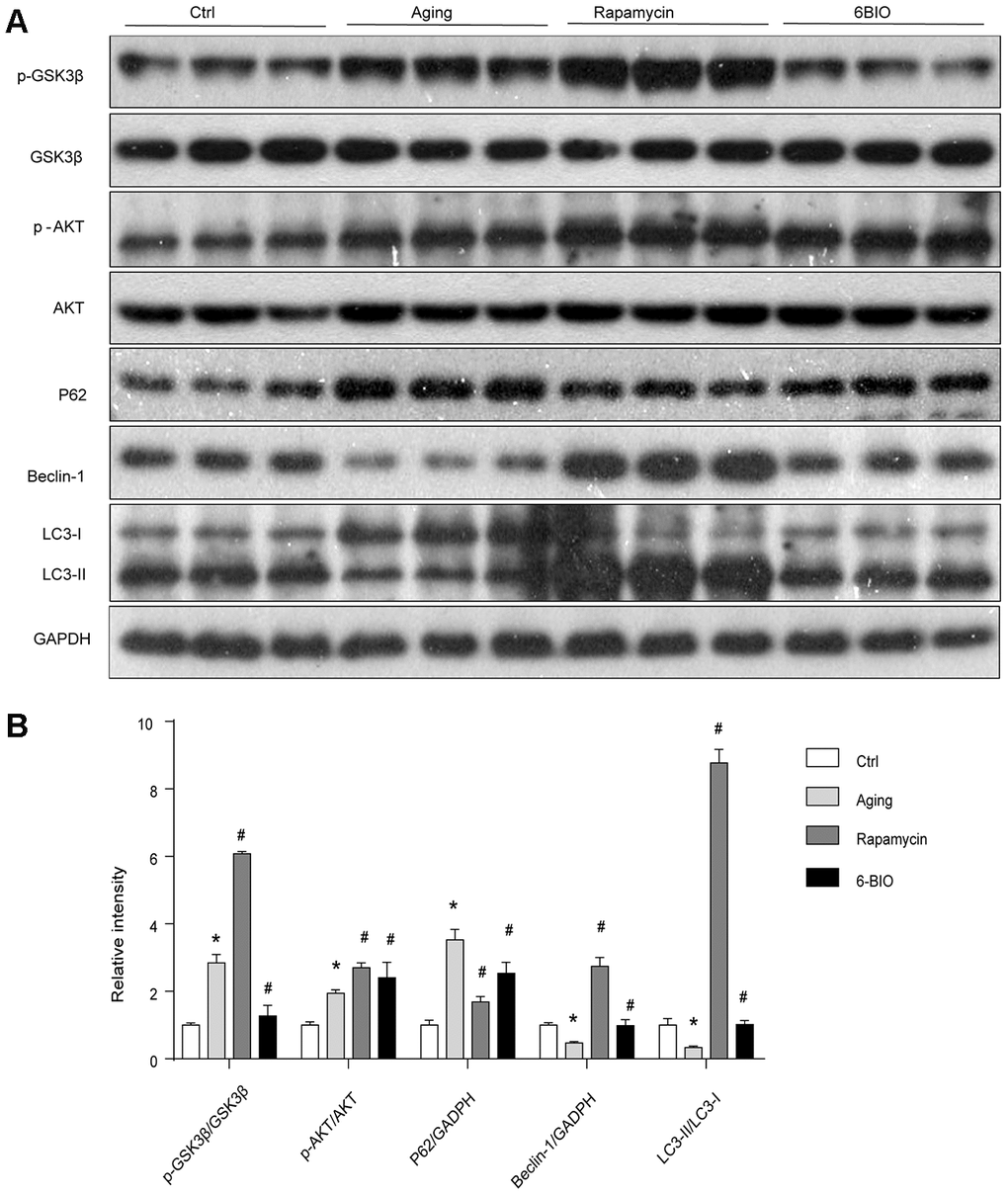 (A, B) GSK3β pathway and the activity of autophagy analyzed by Western blot. *P