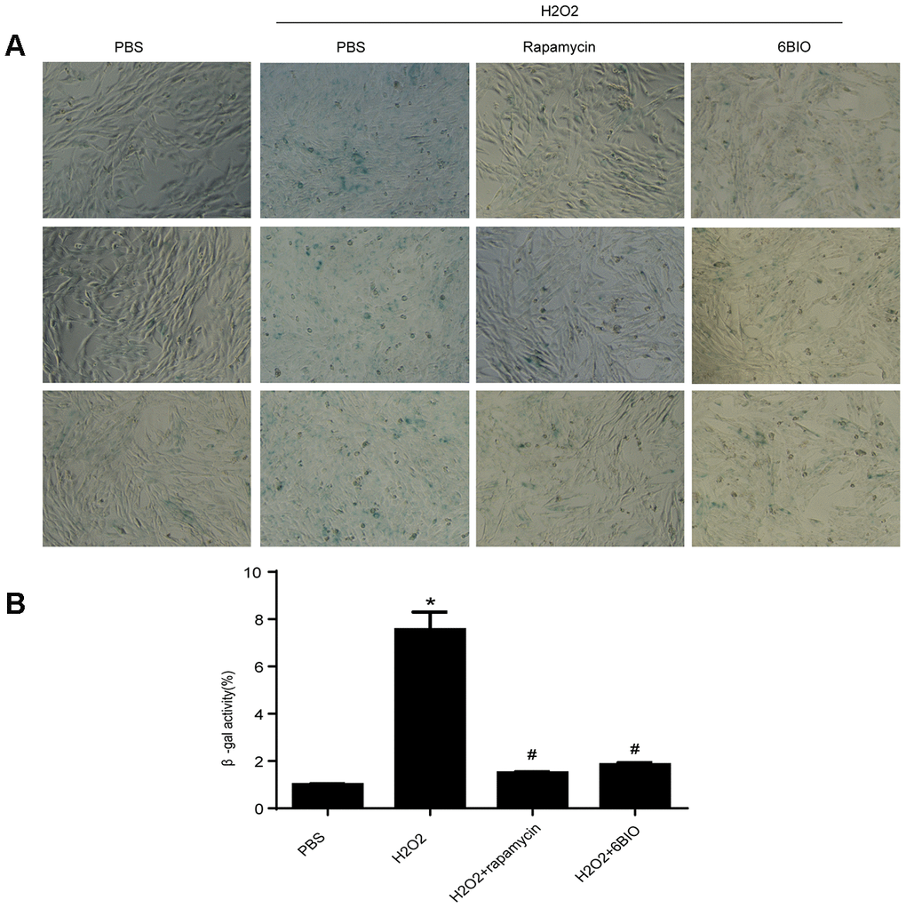 (A) Representative pictures of senescence-associated β -gal staining (×200) and (B) evaluation of senescence-associated β -gal activity assay. *P
