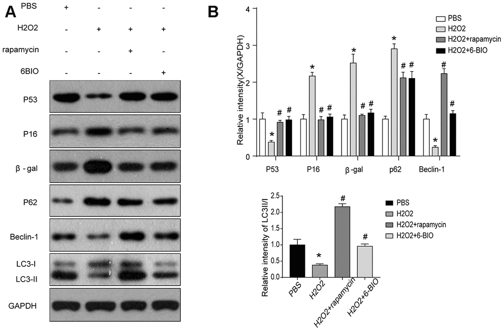 (A, B) Senescence markers and the activity of autophagy in vitro analyzed by Western blot.
