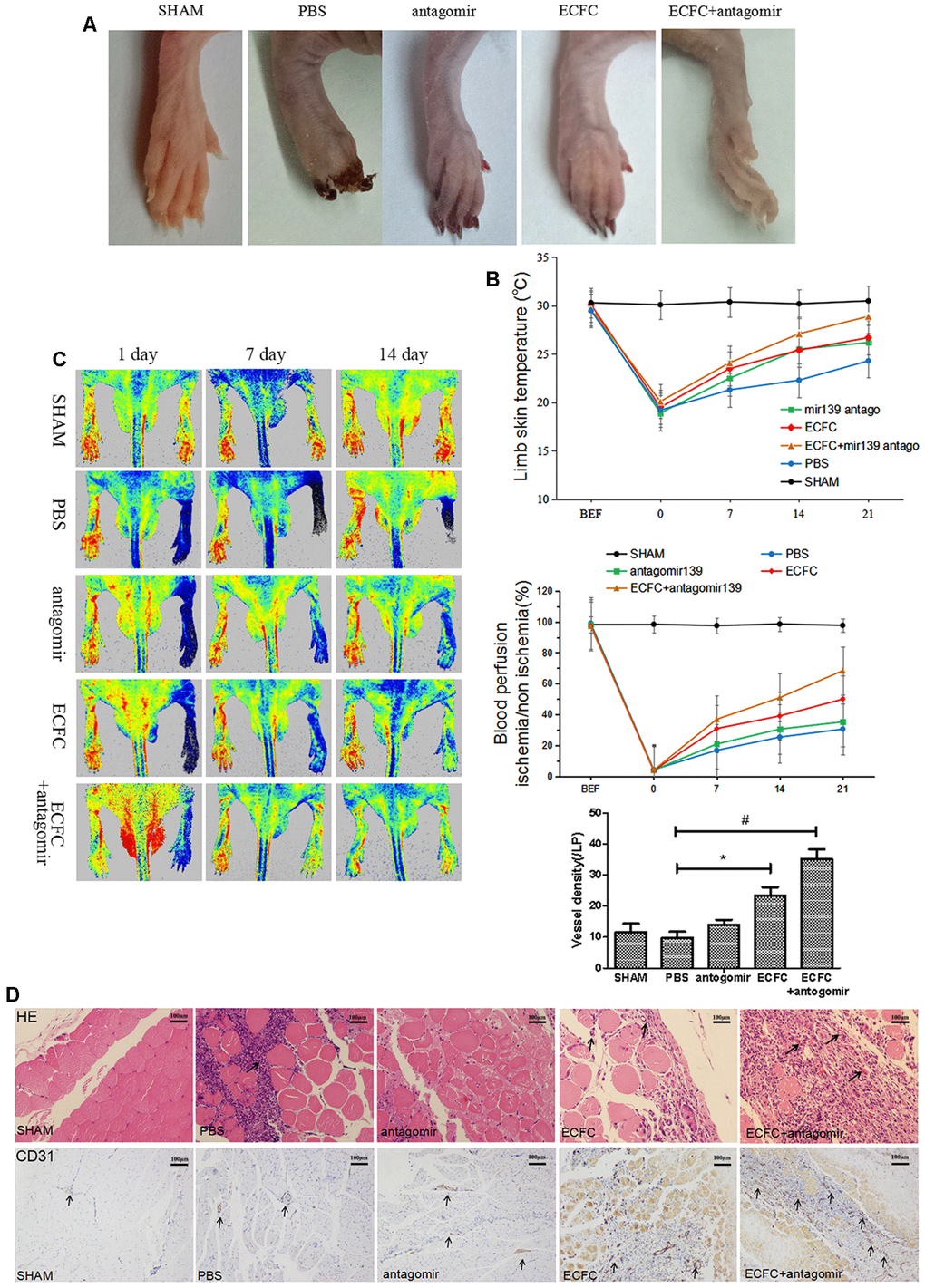 Downregulating miR-139-5p expression promotes ECFC-mediated angiogenesis and blood perfusion in hind limb ischemia (HLI) in diabetic mice. (A) Representative ischemia photographs of 5 groups taken 14 days after injections. Group A: Sham; Group B: PBS; Group C: antagomiR-139; Group D: ECFC; Group E: ECFCs + antagomiR-139. (B) Time-dependent effect of ECFC and/or antagomiR-139 treatment on skin temperature of lower extremity in ischemic mice. (N=3) *P#PC) Improved limb blood perfusion by transplanting ECFC and antagomir-139-5p in ischemic limb of diabetic mice. The time course of blood perfusion is shown in the images and quantitative analysis after HLI surgery with or without ECFC transplantation and/or antagomir-139-5p. Blood perfusion is the ratio of ischemic to non-ischemic limb perfusion measured by a PeriCam Perfusion Speckle Imager. (N=3) *P#PD) Effect of ECFC transplantation and/or antagomiR-139 on vascular density of lower extremity in ischemic mice. Vascular density was determined by counting the number of CD31-stained blood vessels (brown, black arrow) under 5 high-power fields (200X) of normal optical microscope. (N=3) *P#P