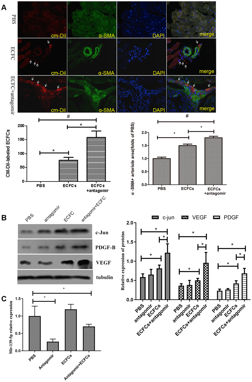 The molecular changes in HLI diabetic mice after injecting miR-139-5p antagomir or ECFCs. (A) Representative fluorescent images and quantitation of CM-DiI-labeled ECFCs (red, white arrow) and alpha smooth muscle actin (α-SMA)-positive arteriole in the ischemic adductor muscle tissue (green), as well as the merged images of CM-DiI, α-SMA, and DAPI. The representative images of arteriogenesis were expressed as α-SMA-positive arteriole area under 5 high-power fields (200X) by PBS control. (N=3) *PB) C-jun, PDGF-B, and VEGF expression in gastrocnemius muscle of ischemic lower extremity. (N=3) *PC) MiR-139-5p expression in gastrocnemius muscle of ischemic lower extremity. (N=3) *P