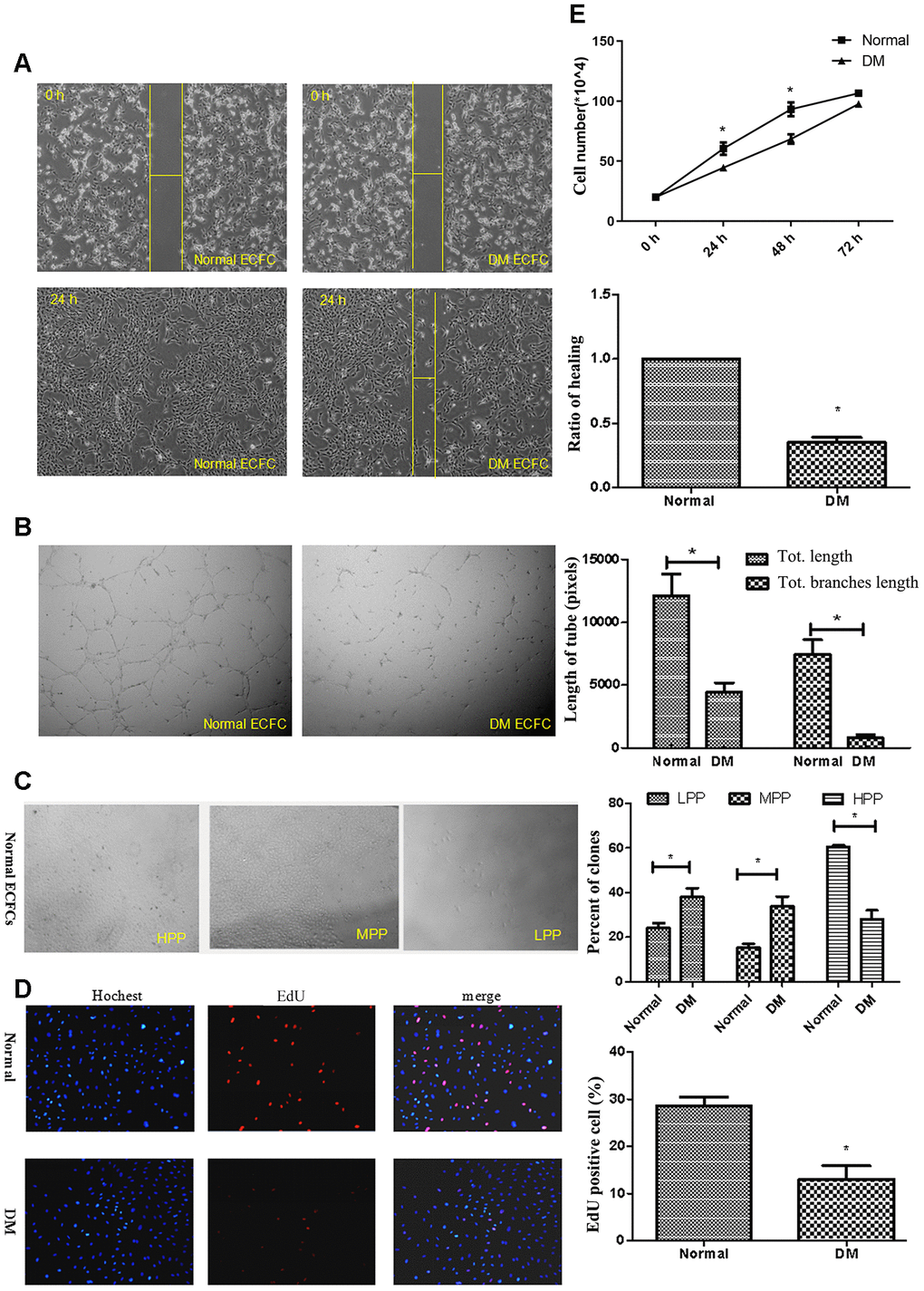 ECFCs isolated from diabetic patients showed dysfunction. (A) Scratch experiments detected the migration ability of ECFCs. (N=3) *P B) Matrigel assays performed for tube formation experiments identified the angiogenesis of ECFCs. The photos were captured with a 40X microscope. (N=3) *P C) Single cloned cell proliferation experiments detected the proliferation ability of single cells. Cell number 10,000 was high clone (HPP). The cell was seeded into a 96-well plate and the ratio of clones was counted. (N=3) *P D, E) The proliferative ability of diabetic ECFCs was found to be impaired. The nucleus was dyed blue by Hoechst stain and the proliferating cells were dyed red by 5-ethynyl-2′-deoxyuridine. The photos were captured by a 40X microscope. (N=3) (D). Hemocytometer counting of ECFCs in 24, 48, and 72h after seeding at the density of 2x104cells/well. (N=3) *P E). Data shown in the graphs represent mean ± standard deviation.