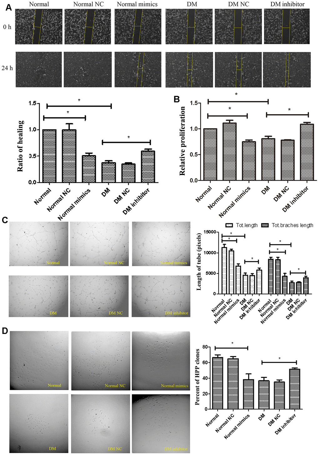 MiR-139-5p inhibits the function of ECFCs. (A, B) Migration and proliferation of normal ECFCs transfected with miR-139-5p mimics and DM ECFCs transfected with miR-139-5p inhibitors were assessed. The photos were captured by a 40X microscope and the statistics performed by Image J. (N=3) *P C) Tube formation of normal ECFCs transfected with miR-139-5p mimics and DM ECFCs transfected with miR-139-5p inhibitors were assessed. The photos were captured by a 40X microscope and the statistics performed by Image J. (N=3) *P D) The cloning ability of normal ECFCs transfected with miR-139-5p mimics and diabetic ECFCs transfected with miR-139-5p inhibitors were detected using single cell clone experiments. (N=3) *P 