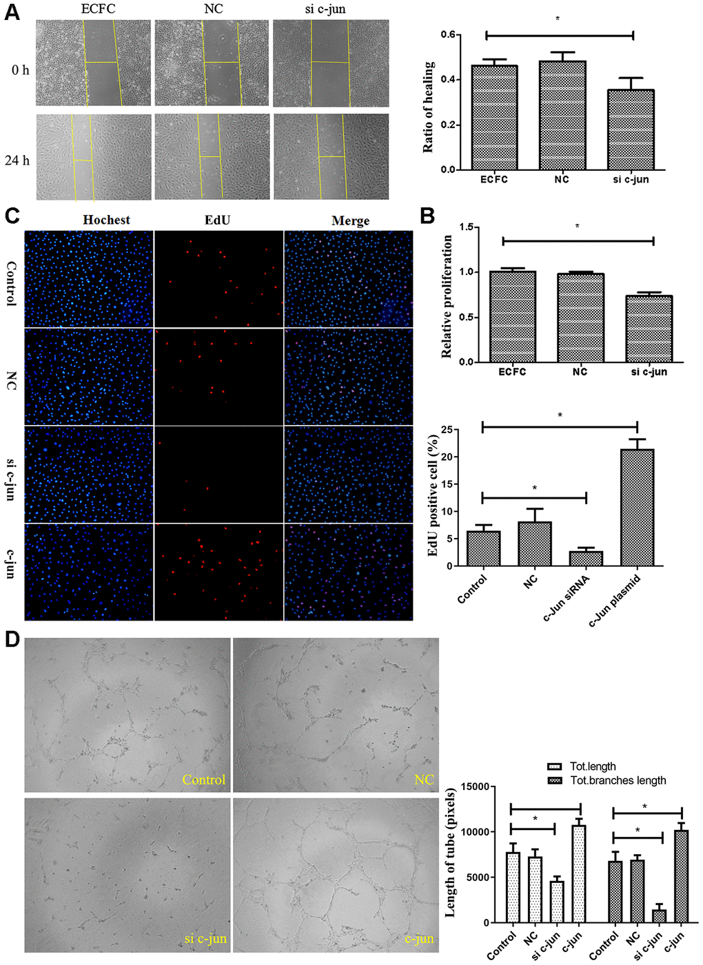 Effect of c-jun on ECFCs. (A) Scratch assay detected the migration ability of ECFC transfected with c-jun siRNA. (N=3). (B, C) CCK8 and cell counting detected the proliferative ability of ECFCs treated with c-jun siRNA or overexpress plasmid. The nucleus was dyed blue by Hoechst stain and the proliferating cells were dyed red by 5-ethynyl-2′-deoxyuridine. The photos were captured by a 40X fluorescence microscope. (N=3) *P D) In vitro tube formation experiments detected the angiogenesis ability of ECFCs with different treatment. The photos were captured by a 40X fluorescence microscope. (N=3) *P 