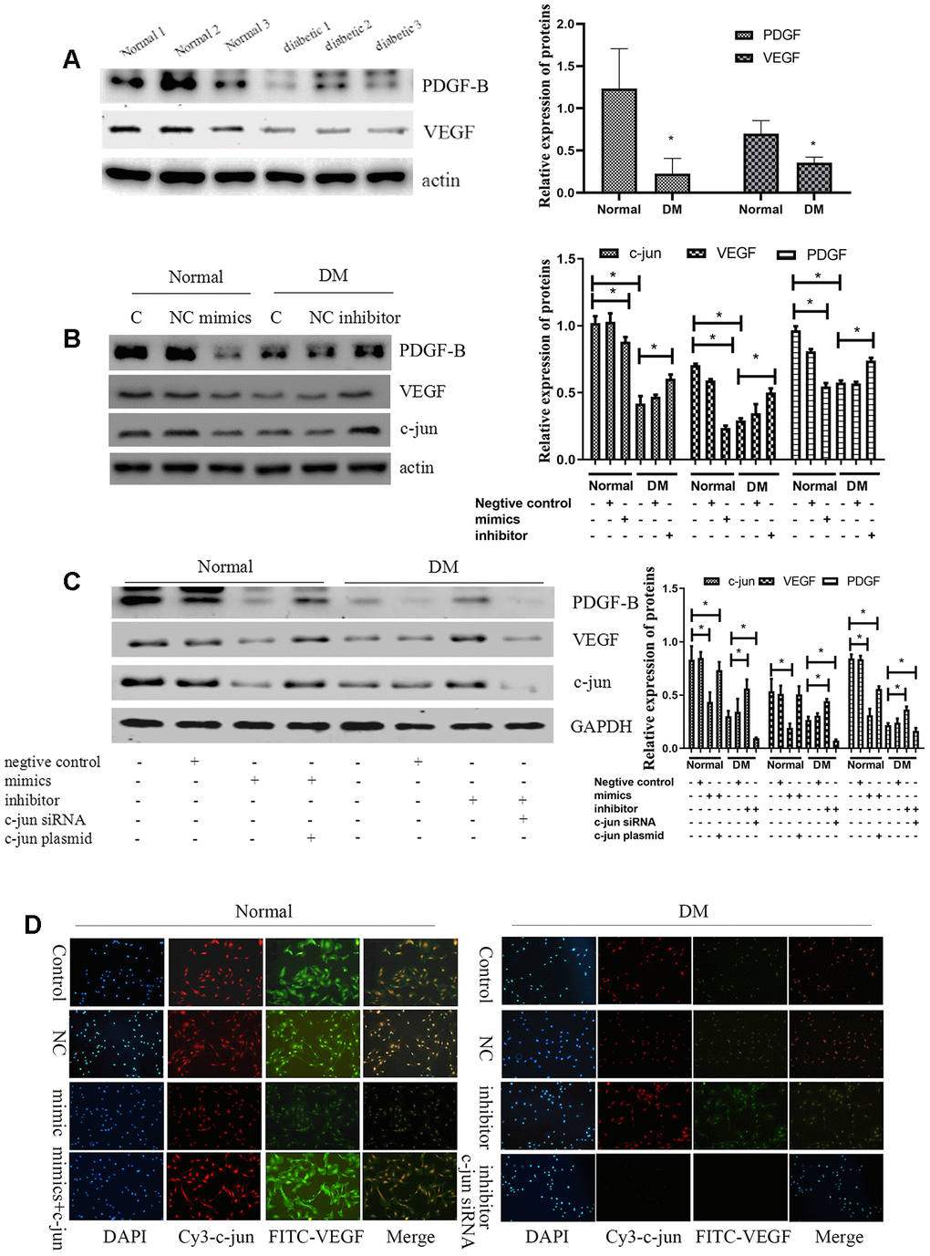 MiR-139-5p inhibits VEGF expression by c-jun to inhibit the function of ECFCs. (A) PDGF-B and VEGF expression detected by Western blot in healthy and diabetic subjects. (N=3) *P B) C-jun, VEGF, and PDGF-B expression in normal ECFCs transfected with miR-139-5p mimics and diabetic ECFCs transfected with a miR-139-5p inhibitors. (N=3) *P C) C-jun, VEGF, and PDGF-B expression was detected when normal ECFCs were transfected with miR-139-5p mimics and c-jun plasmids and diabetic ECFCs were transfected with miR-139-5p inhibitors and c-jun siRNA. (N=3) *P D) C-jun and VEGF expression was detected in normal ECFCs co-transfected with miR-139-5p mimics and c-jun plasmid, whereas diabetic ECFCs were co-transfected with miR-139-5p inhibitors and c-jun siRNA. The immunofluorescence was used to identify the c-jun and VEGF expression. Red indicates Cy3-labeled c-jun and green indicate FITC-labeled VEGF. The photos were captured by a 40X fluorescence microscope. (N=3) *P 
