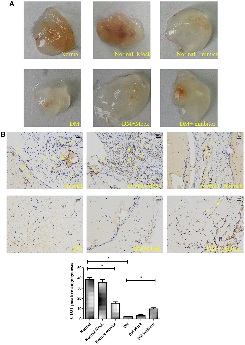 MiR-139-5p prevents tube formation in vivo. Matrigel was mixed with the normal ECFCs transfected with miR-139-5p mimics or diabetic ECFCs transfected with miR-139-5p inhibitors. The mixed Matrigel was inoculated into the abdomen of nude mice. After 2 weeks, the Matrigel was separated from euthanized mice. (A) Representative photographs. (N=4) *P B) CD31 histological images under high-power fields (200X) of normal optical microscope. (N=3) *P 