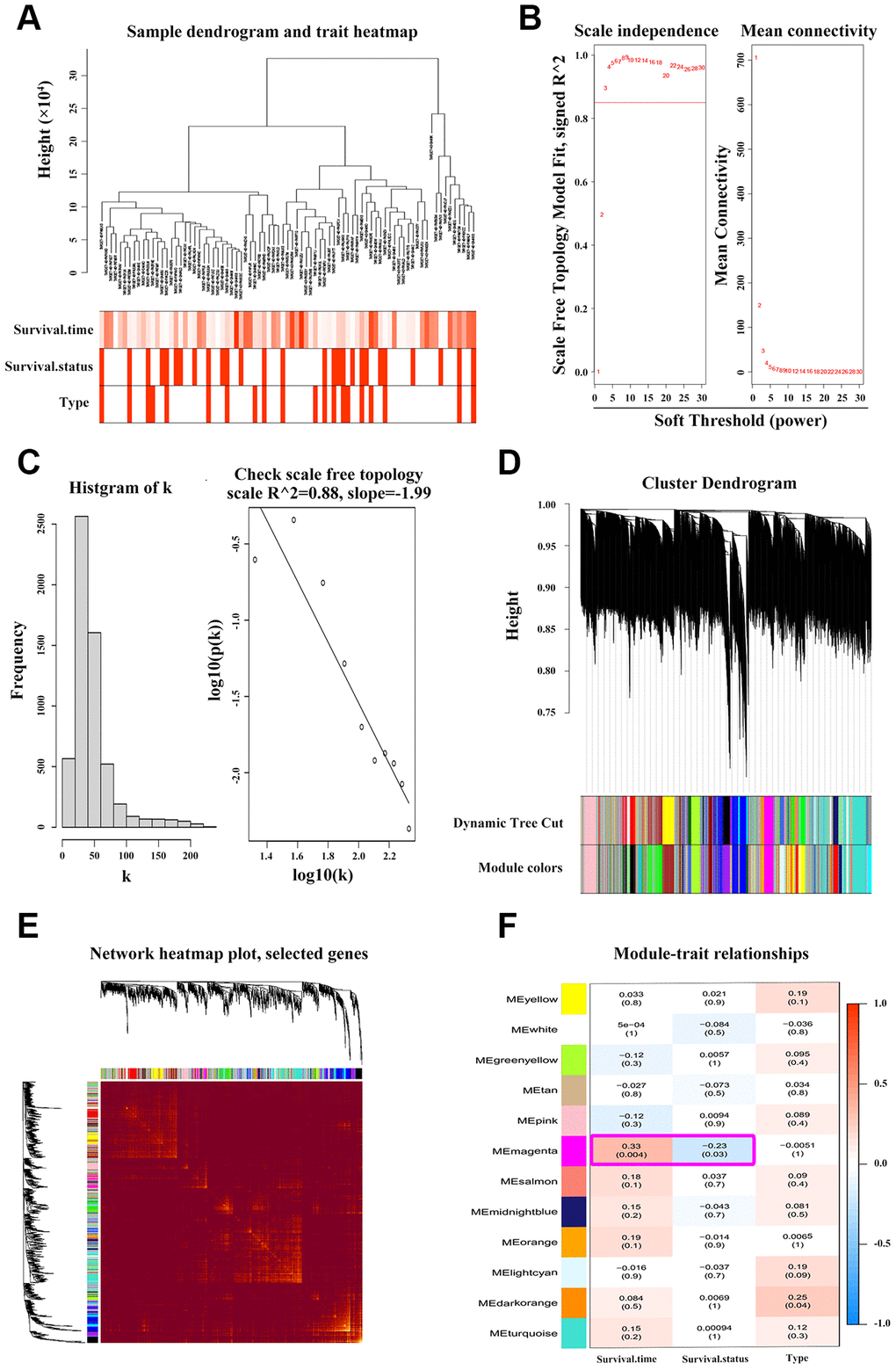 WGCNA discoveries the key ANXA1-entered module. (A) Hierarchical clustering dendrogram of tumor samples from TARGET