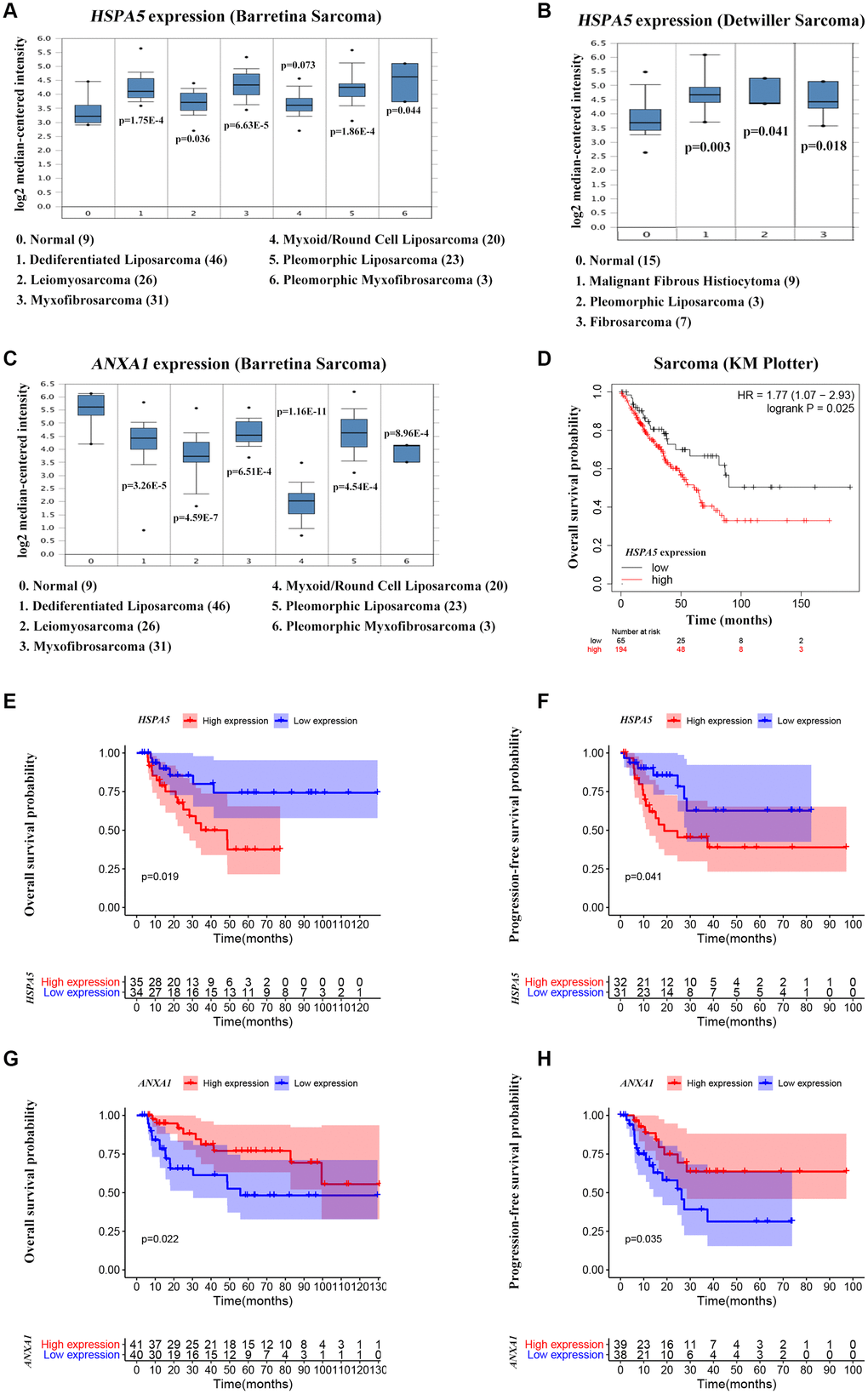 High ANXA1 expression and low HSPA5 expression are involved in good outcomes of OS patients. (A–C) Box plots showing differential mRNA levels of ANXA1 and HSPA5 between sarcoma and normal tissues from ONCOMINE database. (D) The correlation of HSAP5 expression with the overall survival of sarcoma patients shown in Kaplan-Meier curve from KM plotter database. (E, F) The correlation of HSAP5 expression with the overall survival (69 cases) and progression free survival (63 cases) of OS patients shown in Kaplan-Meier curves from TARGET