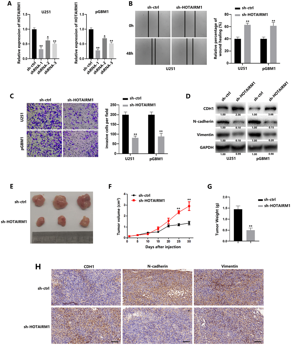 HOTAIRM1 promotes migration and invasion of GBM cells and tumor growth in vivo. (A) Relative expression of HOTAIRM1 in cells transfected with HOTAIRM1 shRNA and negative control. (B) Wound healing assays were used to analyze migration of GBM cells. (C) Matrigel invasion assays were used to analyze invasion of GBM cells. (D) EMT-associated proteins in GBM cells were determined using western blotting. (E) Representative images of subcutaneous tumors originated from sh-ctrl– or sh-HOTAIRM1–transfected pGBM1 cells on the da\ ys indicated. (F) Growth curve of tumors originated from sh-ctrl– or sh-HOTAIRM1–transfected pGBM1 cells. (G) Weight of tumors originated from sh-ctrl– or sh-HOTAIRM1–transfected pGBM1 cells. (H) Representative IHC results of CDH1, N-cadherin and Vimentin in tumors. *P P 