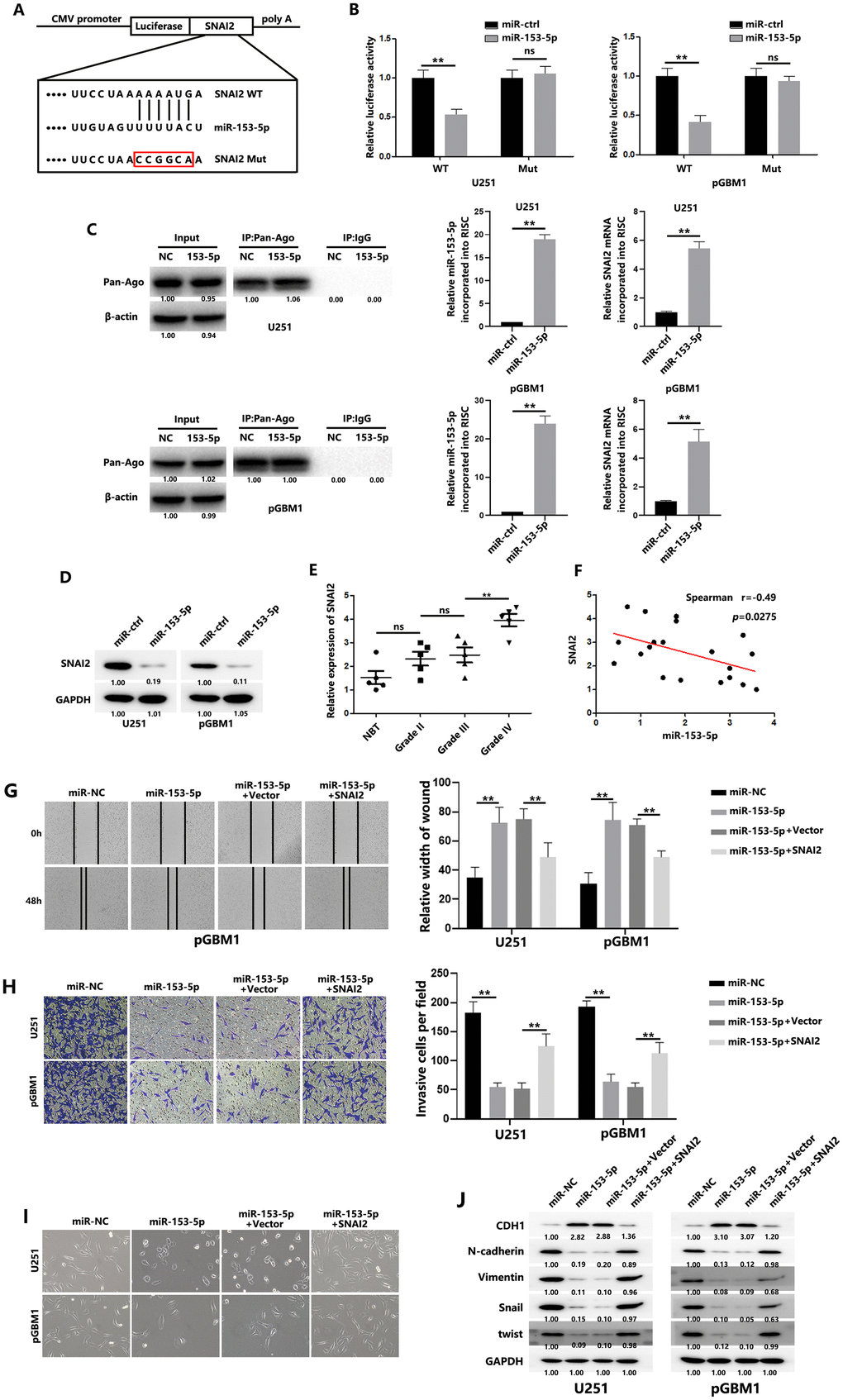 SNAI2 is a direct target of miR-153-5p. (A) Schematic diagram shows the predicted miR-153-5p binding sites with the 3′-UTR of SNAI2. The sequences of wild-type and mutant 3′-UTR of SNAI2 are also listed. (B) Luciferase assays were performed to measure the luciferase activity in GBM cells. (C) (Left): Immunoprecipitation of the Ago2/RISC using the Pan-Ago2 antibody in U251 or pGBM1 cells overexpressing miR-NC or miR-153-5p. IgG was used as a negative control, and β-actin was used as an internal control. (Middle): qRT-PCR analysis of miR-153-5p incorporated into RISC in U251 or pGBM1 cells overexpressing miR-153-5p compared to the levels in the control. U6 RNA was used as an internal control. (Right): qRT-PCR of SNAI2 incorporated into RISC in U251 or pGBM1 cells overexpressing miR-153-5p. GAPDH RNA was used as an internal control. (D) Western blot analysis indicated that SNAI2 expression levels were decreased in cells with miR-153-5p overexpression. (E) SNAI2 expression levels in 5 normal brain tissues and 15 glioma specimens (5 glioma tissues in each group: WHO grades II, III, and IV) were examined using qRT-PCR. (F) Spearman correlation analysis was used to confirm the correlation between the SNAI2 and miR-153-5p levels in 20 human glioma specimens. (G) Wound healing assays were used to analyze migration of GBM cells. (H) Matrigel invasion assays were used to analyze invasion of GBM cells. (I) Morphological changes of GBM cells were imaged to analyze EMT process of GBM cells. (J) EMT-associated proteins in GBM cells were determined by western blotting. *P P 