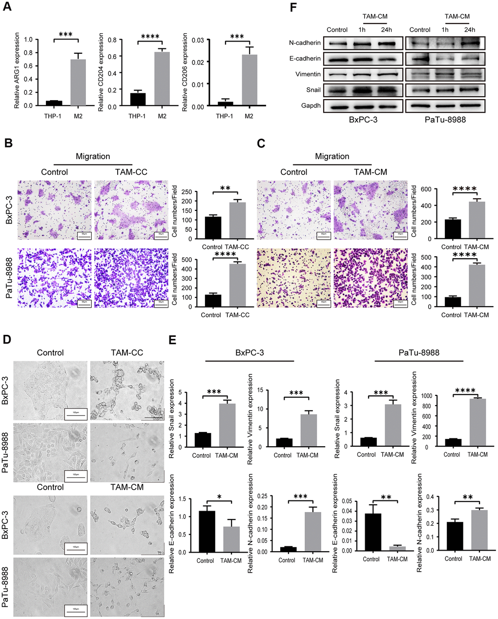 TAMs promote in vitro PDAC cell migration via EMT. (A) QRT-PCR analysis shows relative expression of M2-type macrophage markers such as CD206, CD204, and ARG1 in IL-4-treated THP-1 cells compared to the corresponding controls. ***P B) Transwell assay results show the migration and invasiveness of BxPC-3 and PaTu-8988 cells co-cultured with TAMs (TAM-CC) and their corresponding controls. Scale bar = 50 μm; **P C) Transwell assay results show the migration and invasiveness of BxPC-3 and PaTu-8988 cells treated with TAM conditional medium (TAM-CM) and their corresponding controls. Scale bar = 50 μm; ****P D) Representative images show the morphology of BxPC-3 and PaTu-8988 cells co-cultured with TAMs or TAM-CM and with their corresponding controls. Scale bar = 100 μm. (E) QRT-PCR analysis shows the relative mRNA levels of EMT markers, E-cadherin, N-cadherin, and Vimentin in BxPC-3 and PaTu-8988 cells treated with TAM-CM and their corresponding controls. *P F) Western blot analyses show the levels of EMT marker proteins, E-cadherin, N-cadherin, and Vimentin in BxPC-3 and PaTu-8988 cells treated with TAM-CM and their corresponding controls.