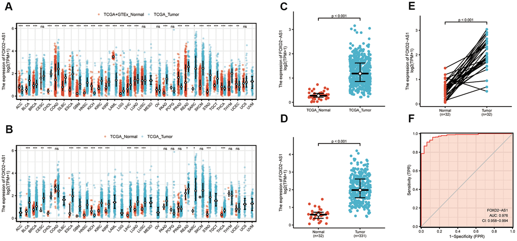 Expression level of FOXD2-AS1 was upregulated in most cancer types including OSCC. (A) FOXD2-AS1 expression in pan-cancer from normal TCGA samples of GTEx combined with samples of TCGA head and neck squamous cell carcinoma. (B) FOXD2-AS1 expression in pan-cancer of tumor tissues and paracancer tissues from TCGA. (C) FOXD2-AS1 expression of normal samples and tumor samples in TCGA head and neck squamous cell carcinoma. (D) FOXD2-AS1 expression of normal samples and tumor samples in OSCC patients. (E) FOXD2-AS1 expression of tumor tissues and paracancer tissues in OSCC patients. (F) ROC analysis of FOXD2-AS1 expression showing promising discrimination power between tumor and normal tissues.