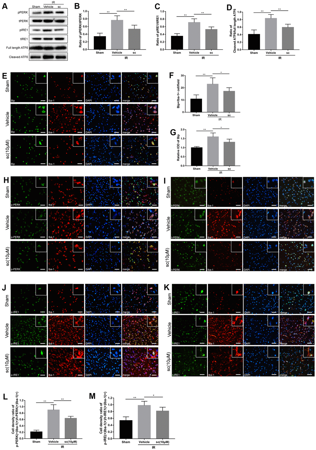 Microglial endoplasmic reticulum (ER) stress was mitigated by PTP1B inhibitor treatment after cerebral ischemia/reperfusion (IR) injury in rats. (A) Western blot to detect the effect of PTP1B inhibitor (10 μM) on phospho-PERK, total-PERK, phospho-IRE1, total-IRE1, cleaved ATF6, and full length ATF6 protein expression in the rat ipsilateral cortex 24 h after IR injury (n = 5 per group). (B–D) Quantitative analysis of band density ratio of phosphor-PERK/total-PERK, phospho-IRE1/total-IRE1, and cleaved ATF6/full length ATF6. Results are presented as the mean ± SEM (n = 4 per group). (E) Double immunofluorescence to detect Bip expression in microglia (Iba-1) 24 h after IR injury. Scale bar = 50 μm. (F, G) Quantitative analysis of Bip+/Iba-1+ cell density and relative integrated optical density (IOD) of Bip in the ipsilateral cerebral cortex (presented as the mean ± SEM, n = 5 per group). (H–K) Double immunofluorescence to detect phospho-PERK, PERK, phospho-IRE1, and IRE1 expression in microglia (Iba-1) 24 h after IR injury. Scale bar = 50 μm. (L, M) Quantitative analysis of double-positive cell density ratio of p-PERK(+)Iba-1(+)/PERK(+)/Iba-1(+) and p-IRE1(+)Iba-1(+)/IRE1(+)Iba-1(+) in the ipsilateral cerebral cortex (presented as the mean ± SEM, n = 6 per group). *p p p 