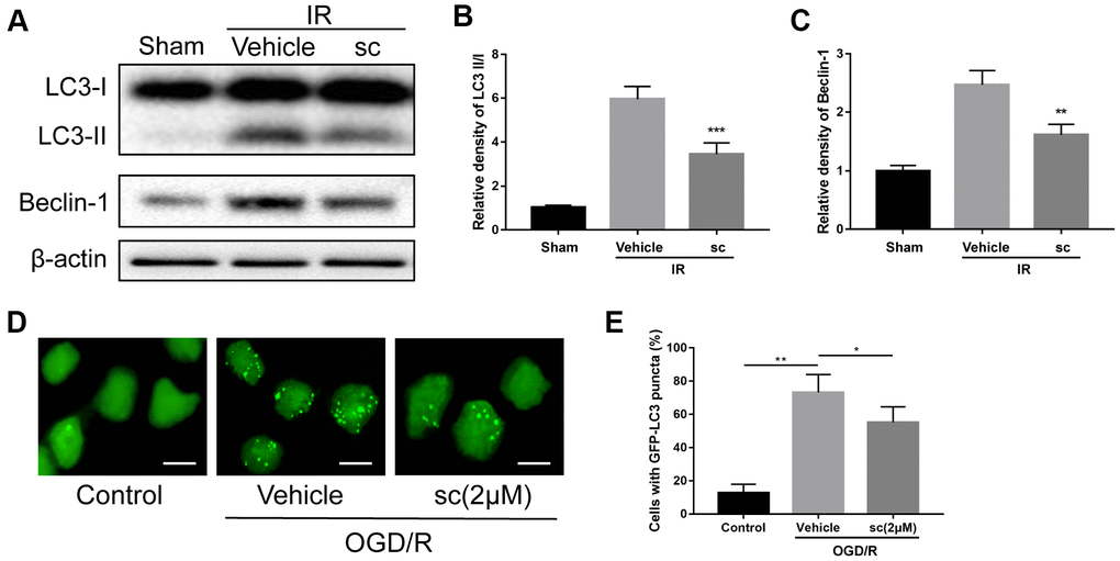 Microglial autophagy was mitigated by PTP1B inhibitor treatment after IR injury. (A) Western blot to detect the effect of PTP1B inhibitor (10 μM) on LC3-I/II and beclin-1 protein expression in the rat ipsilateral cortex 24 h after IR injury. (B, C) Quantitative results of relative band density are normalized to β-actin and presented as the mean ± SEM (n = 4 per group). (D) Immunofluorescence to detect GFP-LC3B puncta in GFP-LC3 expressing BV-2 cells. Scale bar = 200 μm. (E) Graph showing percentage of cells with GFP-LC3 puncta (presented as the mean ± SEM, n = 6 per group). *p p p 