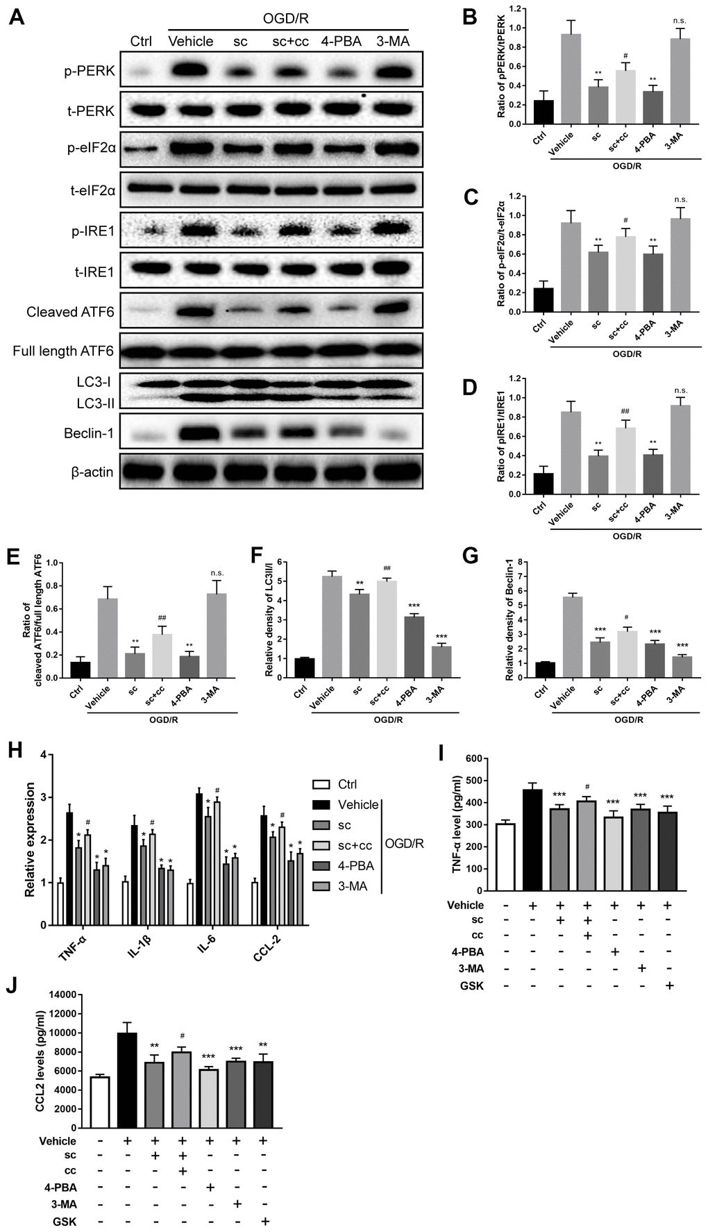 PTP1B inhibitor mitigated oxygen glucose deprivation/reoxygenation (OGD/R)-induced microglial activation by inhibiting ER stress-dependent autophagy via PERK signaling. (A) The PTP1B inhibitor, sc-222227, 4-PBA, and 3-MA were used to specifically inhibit PTP1B, ER stress, and autophagy in primary microglia, respectively. CCT020312 was used to activate PERK. GSK2606414 was used to inhibit PERK. Western blots were performed to detect p-PERK, PERK, p-eIF2α, eIF2α, p-IRE1, IRE1, cleaved ATF6, full length ATF6, LC-3I/II, and beclin-1 in primary microglia after OGD/R insult. (B–G) Quantitative results of the band density ratio of phosphor-PERK/total-PERK, phospho-eIF2α/total- eIF2α, phospho-IRE1/total-IRE1, and cleaved ATF6/full length ATF6; the relative band density of LC3II/I and beclin-1 are normalized to β-actin. The results are presented as the mean ± SEM (n = 4 per group). (H) Real-time PCR results showing the relative expression of TNF-α, IL-1β, IL-6, and CCL2 in primary microglia in response to treatment with PTP1B inhibitor, PTP1B inhibitor+PERK activator, 4-PBA, 3-MA, and PERK inhibitor after OGD/R insult. Data are normalized to β-actin and presented as the means ± SEM (n = 4 per group). (I, J) ELISA assay to detect expression of secreted TNF-α and CCL2 in primary microglia supernatant 24 h after OGD/R insult. Data are expressed as the means ± SEM (n = 4 per group). *p p p p p p 