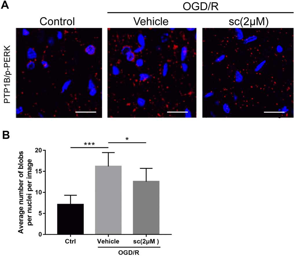 PTP1B inhibitor treatment weakened the protein interaction between PTP1B and phospho-PERK in primary microglia under oxygen glucose deprivation/reoxygenation (OGD/R) conditions. (A) Proximity ligation assay (PLA) probe was used to examine the proximity between PTP1B and phospho-PERK. Scale bar = 20 μm. (B) The average number of blobs per nuclei per image was quantified as the mean ± SEM (n = 6 per group). *p p 