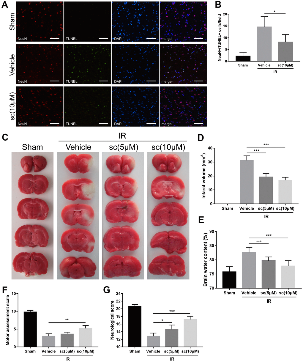 PTP1B inhibitor treatment reduced neuronal apoptosis, cerebral infarct volume, brain water content, and improved neurologic function after ischemia/reperfusion (IR) injury. (A) Immunofluorescence/TUNEL assays were performed to detect neuronal apoptosis in rat ipsilateral cerebral cortex 24 h after IR injury. Scale bar = 50 μm. (B) The density of NeuN+/TUNEL+ cells was quantified as the mean ± SEM (n = 6 per group). (C) TTC staining were performed to determine infarct volume 24 h after cerebral IR injury. Infarct area was defined as the white area. (D) The infarct volume was quantified as (infarct volume/whole brain volume) × 100% (n = 5 per group). (E) Brain water content. (F) Motor assessment score 3 days after IR injury. (G) Neurologic score 3 days after IR injury. Data for d-g are presented as the mean ± SEM (n = 6 per group). *p p p 