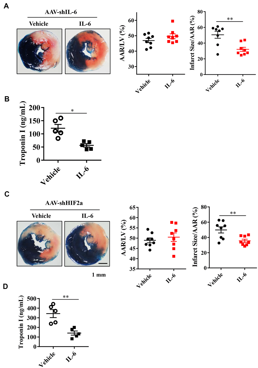 Effect of exogenous IL-6 supplementation on myocardial infarct size and troponin I in endogenous IL-6 knockdown mice or HIF2α deficiency mice. (A) Representative image and quantitative analysis of TTC and Evans blue staining after mouse heart I/R with IL-6 supplementation in IL-6 deficiency mice. n = 8 per group. (B) The results of troponin I release subsequent to I/R. n = 5 per group. (C) Representative image and quantitative analysis of TTC and Evans blue staining after mouse heart I/R with IL-6 supplementation in HIF2α deficiency mice. n = 8 per group. (D) The results of troponin I analysis. n = 5 per group. Data represent the mean± SEM. *PP