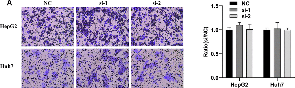 Knockdown of SPATS2 does not inhibit cell migration of HCC cells. (A) Representative and summary of cell migration assays performed with SPATS2 knockdown cells and negative control cells.