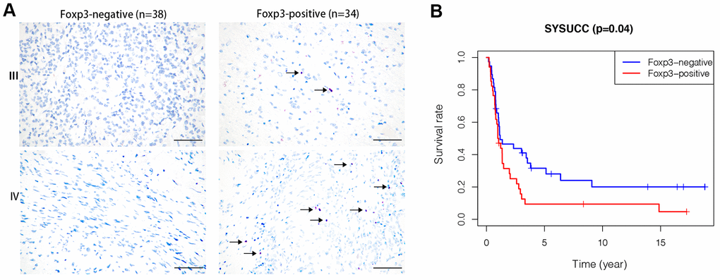 Foxp3 expression in high-grade gliomas from SYSUCC and survival analysis. (A) Foxp3 expression in 72 high-grade gliomas from SYSUCC, black arrows shows the positive cells. The scale bar represents 50 μm. (B) Comparison of survival prognosis between 34 Foxp3-positive patients and 38 Foxp3-negative patients from SYSUCC (Log-Rank test).
