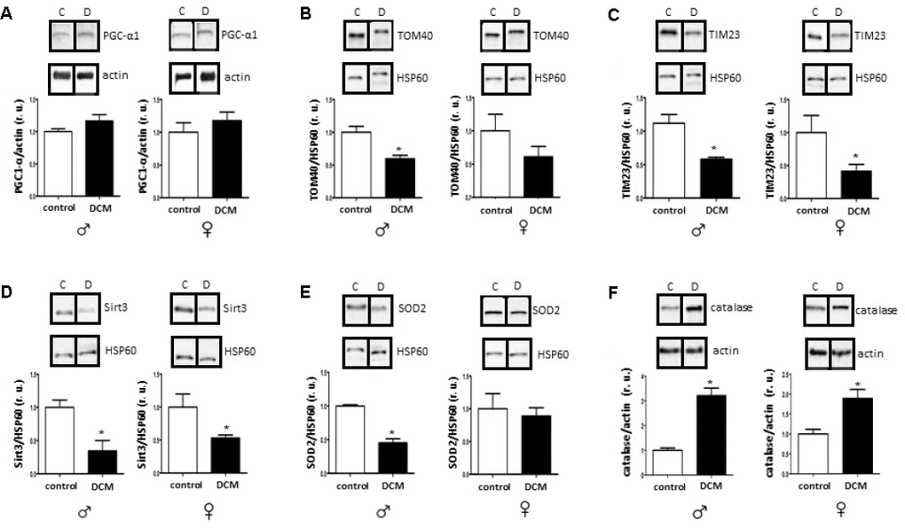 DCM-related alterations in expression of mitochondrial proteins and anti-oxidative enzymes in older patients. Western blot analysis of PGC1-α (A), TOM40 (B), TIM23 (C), Sirt3 (D), SOD2 (E) and catalase (F) expression performed with human cardiac tissue lysates from old control (non-diseased) or DCM men (♂) and women (♀). Representative imaging of western blot analysis; the lanes were run in two gels. All data were normalized to the corresponding control and expressed in relative units (r.u.). Data are means ± SEM (n= 5).