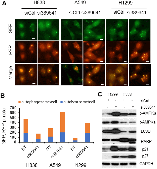 LOC389641 knockdown induces autophagy and apoptosis in lung cancer cell lines. (A, B) H1299, A549 and H838 were treated with LOC389641 siRNAs for 48h and transfected with Premo Autophagy Tandem Sensor RFP-GFP-LC3B for 24h. Cells were visualized live using a fluorescence microscope. Autophagosomes and autolysosomes in each 200X field were counted, at least 100 cells were counted for each siRNA treatment per cell line. Autophagic flow was increased upon LOC389641 silencing in A549 and H1299 cells but were decreased in H838 cells. Scale bar: 5 μm. (C) Western blot showing the changes of autophagy, apoptosis and cell cycle related proteins upon LOC389641 silencing in H1299 and H838 cells (LOC389641 siRNAs treated for 72 h). Apoptosis marker (cleaved-PARP) was induced upon LOC389641 knockdown in H838 cell line.