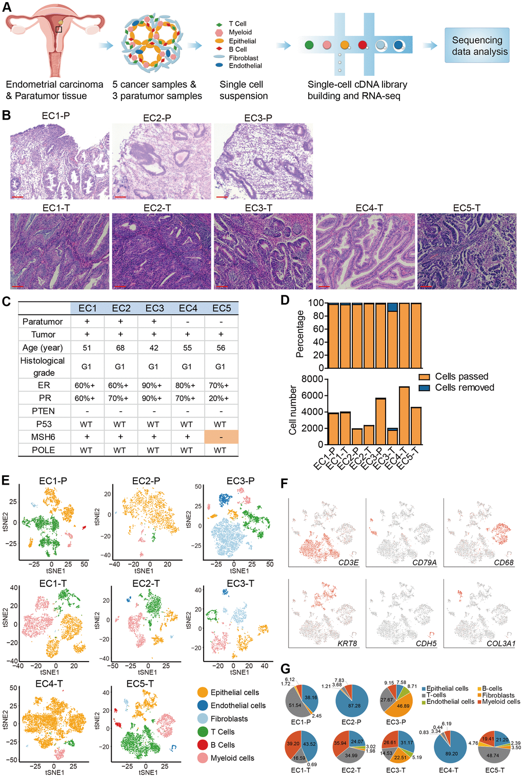 Diversity of cell types in each sample from ECC patients delineated by single-cell transcriptomic analysis. (A) Experimental workflow of scRNA-seq procedure for ECC tumors and paratumor tissues. (B) Hematoxylin and eosin (HE) staining on paratumor and tumor slides of the 5 ECC patients. Scale bars, 100 mm. (C) Samples obtained from 5 EC patients and clinicopathological characteristics of the 5 patients, more details are provided in Supplementary Figure 1B. (D) The remaining cell fraction (left bar plot) and cell number (right bar plot) after quality control and filtering step for each biopsy. (E) The t-distributed stochastic neighbor embedding (t-SNE) plot demonstrates the major cell types in each sample. (F) Expression of representative marker genes of the major cell types defined in EC samples. (G) The percentage of cell types assigned to each sample in (E). Pie charts of cell-type fractions for tumor-infiltrating immune cells of each patient, colored by cell type.