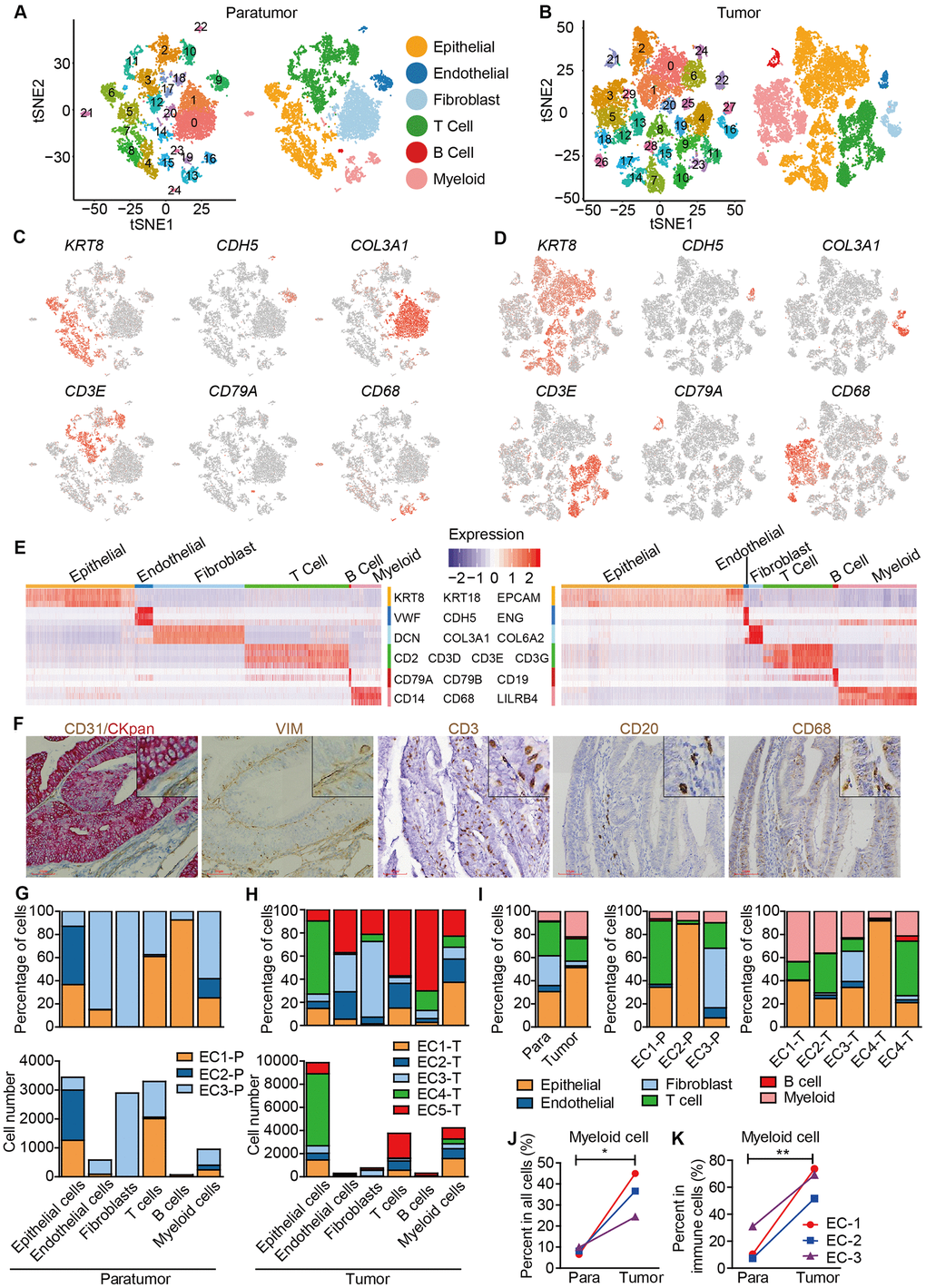 Unbiased characterization of multiple cell types from integrated tumor and paratumor samples. (A, B) t-SNE projection of the 11,275 cells from 3 integrated paratumor samples (A) and 19,505 cells from 5 integrated tumor samples (B), color-coded by their associated cluster (left) or the assigned cell type (right). (C, D) Expression of marker genes of each cell type defined in A and B. (E) Heatmap showing the expression levels of known markers of epithelial cells epithelial cells (KRT8, KRT18, EPCAM), endothelial cells (CDH5, VWF, ENG), fibroblasts (COL3A1, COL6A2, DCN), T cells (CD2, CD3D, CD3E, CD3G), B cells (CD79A, CD79B, CD19) and myeloid cells (CD14, CD68, LILRB4) in Paratumor (left panel) and Tumor (right panel). (F) Representative images of epithelial cells, endothelial cells, fibroblasts, T cells, B cells and myeloid cells of EC4, after IHC staining with CKpan, CD31, VIM, CD3, CD20 and CD68 antibodies, respectively. Scale bars, 80 mm. (G, H) For each cell type: the cell fractions and numbers originating from each of the 3 paratumor and 5 tumor samples are shown. (I) The fractions of the six cell types in paratumor and tumor samples (left), and in each patient (middle and right). (J, K) The percentages of myeloid cells of all cells (J) and immune cells (K) in paratumor and tumor samples. Data were analyzed using a students’ t-test, *P P 