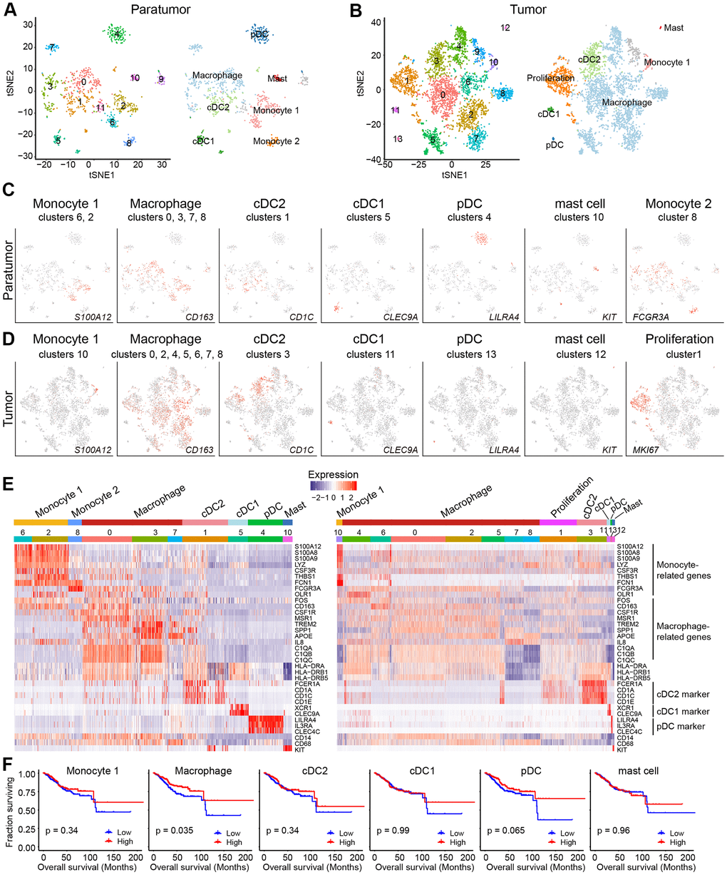 Myeloid cell clusters in paratumors and endometrial tumors. (A, B) t-SNE plot of 936 myeloid cells in Paratumor (A) and 4,152 myeloid cells in Tumor (B), color-coded by their associated cluster (left) or the assigned subtype (right). (C, D) t-SNE plot, color-coded for relative expression (lowest expression to highest expression, gray to red) of marker genes for the myeloid subtypes in Paratumor (C) and Tumor (D). (E) Heatmaps created using known gene expression profiles of myeloid cells in Paratumor (left panel) and Tumor (right panel). The identity of each cluster was assigned using known markers. (F) The overall survival curves based on TCGA-UCEC data (n = 549 patients), stratified for the average expression (binary: high versus low) of tumor myeloid cell marker genes.