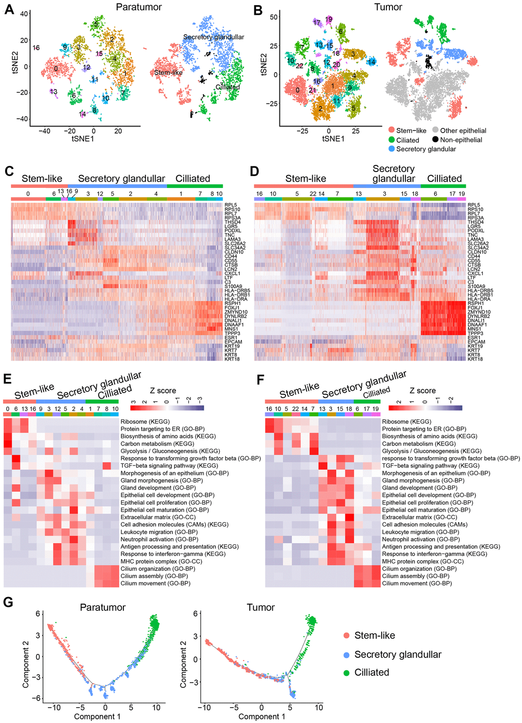 Endometrial epithelial cell clusters in paratumors and endometrial tumors. (A, B) t-SNE plot of 3,403 endometrial epithelial cells in Paratumor (A) and 9,789 endometrial epithelial cells in Tumor (B), color-coded by their associated cluster (left) or the assigned subtype (right). (C, D) Heatmap analysis using known gene expression profiles of endometrial epithelial cells from Paratumor (C) and Tumor (D). The identity of each cluster was assigned by known markers recently reported. (E, F) The enriched gene ontology terms for genes with specific expression in each endometrial epithelial cluster in Paratumor (E) and Tumor (F). Color key from blue to red indicates z-score of -Log10(P value). (G) Pseudo-time analysis of endometrial epithelial cells from Paratumor (left) and Tumor (right) inferred by Monocle2. Each point corresponds to a single cell, and each color represents an endometrial epithelial subtype as indicated.