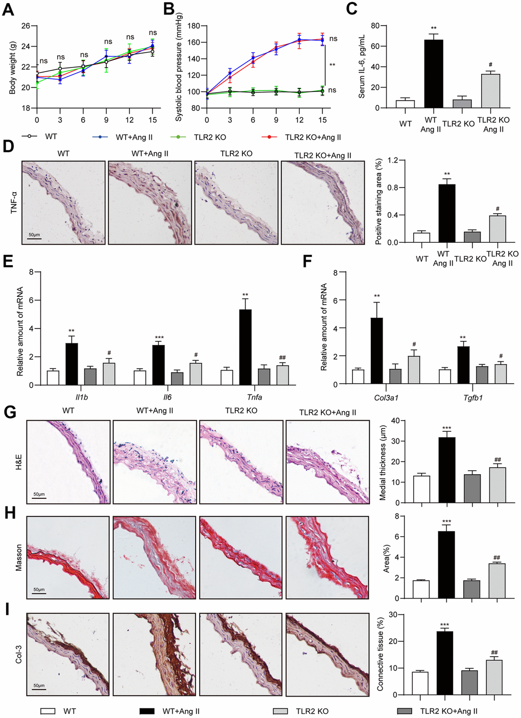 TLR2 deficiency prevents Ang II-induced vascular remodeling in mice. Wildtype (WT) and TLR2 knockout (TLR2KO) mice were challenged with Ang II for 2 weeks. Data showing (A) body weights of mice, (B) systolic blood pressure measurements, and (C) levels of serum interleukin-6 (IL-6). (D) Representative images of TNF-α staining of mouse aortic tissues [scale bar = 50 μm]. Quantification of TNF-α staining area is shown on right. (E, F) mRNA levels of pro-inflammatory and fibrosis-associated genes in aortic tissues [data normalized to β-actin]. (G, H) H&E and Masson's Trichrome staining of mouse aortic sections illustrating the degree of medial thickening and fibrosis [scale bar = 50 μm]. Quantification of medial thickening and connective tissue deposition are shown on right. (I) Representative images of Col-3 staining (brown) of aortic sections. Tissues were counterstained with hematoxylin (blue) [scale bar = 50 μm]. Quantification of Col-3 staining is shown on right. [n = 6-8; Data shown as Mean ± SEM; **p