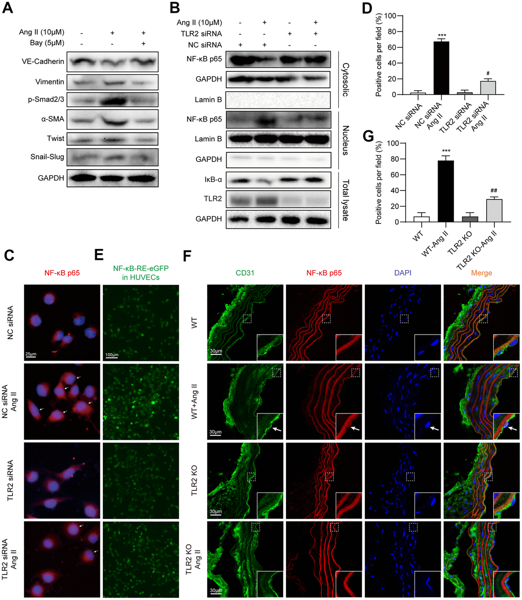 TLR2 regulates EndMT through NF-κB. (A) HUVECs were pretreated with NF-κB inhibitor Bay 11-7085 at 5 μM for 1 h. Cells were then exposed to 10 μM Ang II for 36 h. Levels of EndMT proteins were detected by immunoblotting. GAPDH was used as loading control. (B) HUVECs were transfected with TLR2 siRNA or negative control siRNA. Transfected cells were exposed to 10 μM Ang II for 2 h. Total proteins, and nuclear and cytoplasmic fractions were probed for NF-κB p65 subunit and inhibitor of κBα (IκB). GAPDH was used as loading control for total proteins and cytosolic fractions. Lamin B was used as loading control for nuclear fractions. (C) Cells treated as indicated in Panel B were stained for p65 subunit (red). Counterstaining with DAPI was performed [scale bar = 25 μm]. (D) Quantitative analysis of nuclear p65 staining in HUVECs. Representative staining images are shown in panel C. (E) HUVECs expressing NFκB-EGFP reporter were transfected with NC siRNA or TLR2 siRNA, and challenged with 10 μM Ang II for 2 h. Representative images of EGFP (green) fluorescence of each group are shown [scale bar = 100 μm]. (F) Immunofluorescence staining of aortic tissues for CD31 (green) and NF-κB p65 (red). Tissues were counterstained with DAPI [scale bar = 30 μm]. Inserts showing high-power images of tissues (arrows indicating endothelial cells). (G) Quantitative florescence intensity of p65 in tissues, expressed as percent positive cells. Representative fluorescence images are shown in panel F. [n = 3 in A-E; n = 7 per group in F and G; Data shown as Mean ± SEM; ***pD) or wildtype mice (G); #pD) or WT-Ang II (G)].