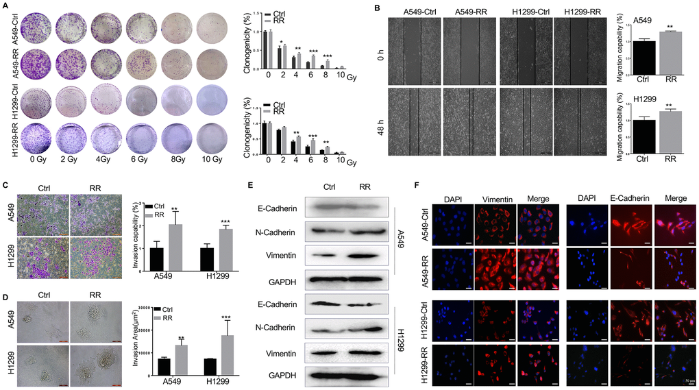 Different radiosensitivity, motility and EMT potential in radioresistant and paternal cells. (A) Count of cell colonies formed 10-12 days after 2-10 Gy radiation treatment. (B) Cell migration analyzed by wound healing assay using wound gap photographs for A549-RR, A549-control, H1299-RR and H1299-control cells. **P C) A549-RR, A549-control, H1299-RR and H1299-control cells were subjected to Matrigel invasion assay and photographed (magnification 20×, scale bar 100 μm) for the analysis of their invasion capacity. **P D) Representative 3D-invasion images of cells. Scale bar:100 μm. (E) Protein levels of E-Cadherin, N-Cadherin and Vimentin measured by Western blot. GAPDH served as the loading control. (F) Vimentin (red) immunofluorescence images of cells. Nuclei were stained with PI (blue) All data from the RR cell line were collected between 5 and 6 weeks post-radiation treatment. All results were from three independent experiments and are presented as mean ± SD. P-values were calculated by student’s t-test.