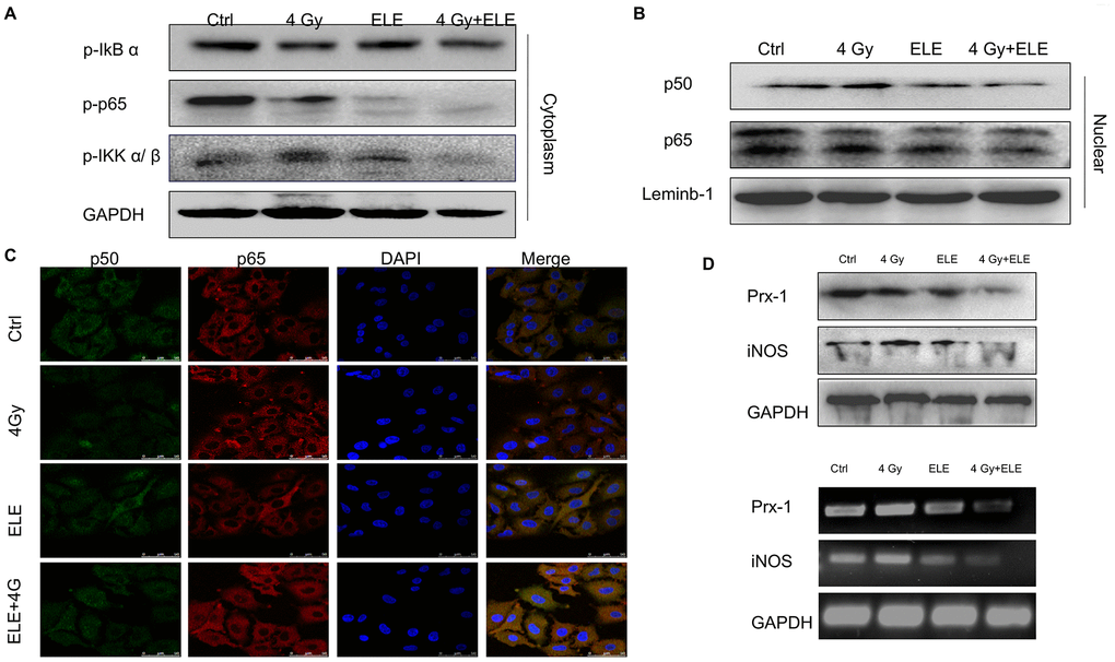 The effect of β-elemene and RT on the expression of Prx-1/NF-kB /iNOS pathway. A549 cells were treated with single RT (4 Gy) or β-elemene prior to RT (4 Gy) Cell lysates were extracted 12 h after RT. (A) The expression of p-IkBα, p-IKK α/β, and p-p65 in cytoplasm were measured by Western blot. (B) The cytoplasmic and nuclear proteins were separated, and the expression of p50/p65 in the nucleus was measured by Western blot. (C) The subcellular localization of p50, p65 in A549 cells treated with β-elemene or RT alone or their combination was examined by confocal microscopy. More than 100 cells were inspected per experiment, and the cells with typical morphology were presented. (D) The A549 cells were treated with β-elemene or RT alone or their combination. The expression of Prx-1 and iNOS at mRNA and protein levels were measured by RT-RCR and Western blot.