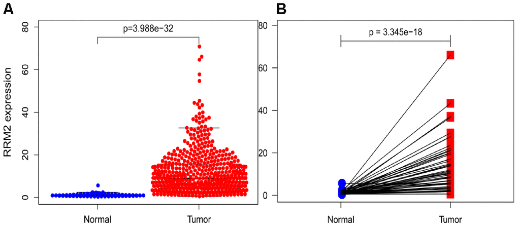RRM2 expression in lung adenocarcinoma tissues. (A) RRM2 expression in normal and tumor tissues. (B) RRM2 expression in paired tissues.