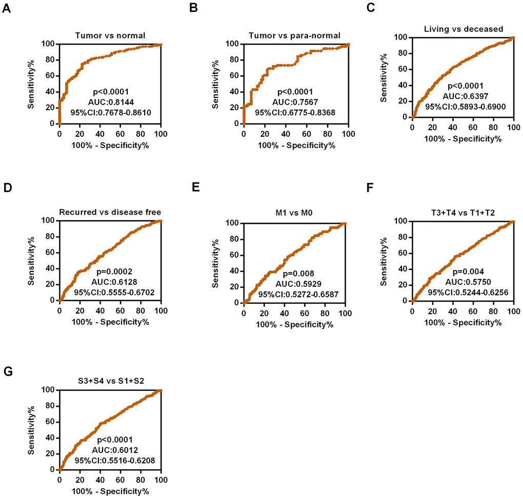 Diagnostic efficiency of HIPK3 in ccRCC. (A) ROC curve of HIPK3 between tumor and non-cancerous normal tissues, the AUC: HIPK3, 0.8144 (pB) ROC curve of HIPK3 between tumor and paired non-cancerous normal tissues, the AUC: 0.7567, (pC) Living vs deceased, AUC:0.6397, (pD) Recurred vs disease free, AUC:0.6128, (pE) M1 / M0 stage, AUC = 0.5929, (p=0.008). (F) (T3 + T4) / (T1 + T2), AUC = 0.5750, (p=0.004). (G) Pathological stage (III + IV)/ (I + II), AUC = 0.6012, (p 